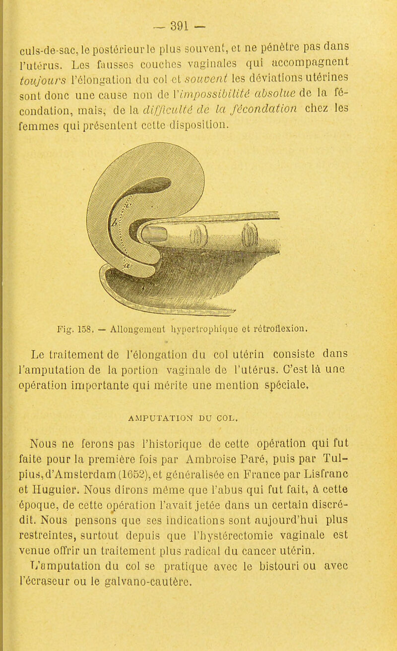 culs-de-sac, le postérieur le plus souvent, et ne pénètre pas dans l'utérus. Les fausses couches vaginales qui accompagnent toujours l'élongation du col et souvent les déviations utérines sont donc une cause non do YLinpossibilité. absolue de la fé- condation, mais, de la difficulté de la fécondation chez les femmes qui présentent cette disposition. Fig. 158. — AUougemeut liypertfophicjuo et rétroflexion. Le traitement de l'élongation du col utérin consiste dans l'amputation de la portion vaginale de l'utérus. C'est là une opération importante qui mérite une mention spéciale, AMPUTATION DU COL. Nous ne ferons pas l'historique de cette opération qui fut faite pour la première fois par Ambroise Paré, puis par Tul- piurf,d'Amsterdam (1652),et généralisée en France par Lisfranc et liuguier. Nous dirons môme que l'abus qui fut fait, à, cette époque, de cette ojDération l'avait jetée dans un certain discré- dit. Nous pensons que ses indications sont aujourd'hui plus restreintes, surtout depuis que l'hystérectomie vaginale est venue offrir un traitement plus radical du cancer utérin. L'amputation du col se pratique avec le bistouri ou avec l'écraseur ou le galvano-cautère.