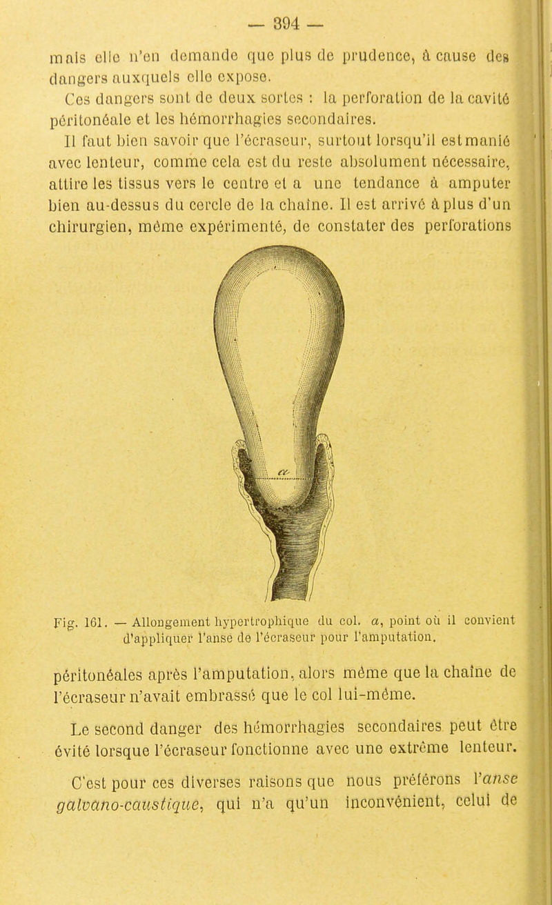 mais elle n'en demanOe que plus de prudence, à cause des dangers auxquels elle expose. Ces dangers sont de deux sortes : la perforation de la cavité péritonôale et les hémorrhagies secondaires. Il faut bien savoir que l'écraseur, surtout lorsqu'il est manié avec lenteur, comme cela est du reste absolument nécessaire, attire les tissus vers le centre et a une tendance à amputer bien au-dessus du cercle de la chaîne. 11 est arrive à plus d'un chirurgien, même expérimenté, de constater des perforations Fig. 161. — Allongement hypertropliique du col. a, point où il convient d'appliquer l'anse de l'écraseur pour raraputation. péritonéales après l'amputation, alors même que la chaîne de l'écraseur n'avait embrassé que le col lui-même. Le second danger des hémorrhagies secondaires peut être évité lorsque l'écraseur fonctionne avec une extrême lenteur. C'est pour ces diverses raisons que nous préférons Vanse galmno-caustique, qui n'a qu'un inconvénient, celui de