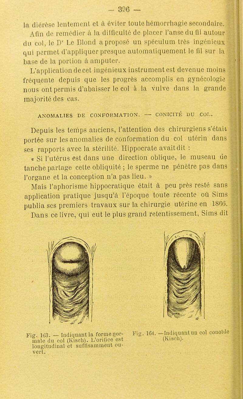 la diérèse lentement et à éviter toute hémorrhagie secondaire. Afin de remédier à la dilficultc de placer l'anse du fil autour du col, le D' Le Blond a proposé un spéculum très ingénieux qui permet d'appliquer presque automaliquement le fil sur la base de la portion à amputer. L'application de cet ingénieux instrument est devenue moins fréquente depuis que les progrès accomplis en gynécologie nous ont permis d'abaisser le col à la vulve dans la grande majorité des cas. ANOMALIES DE CONFORMATION. — CONICITÉ DU COL. Depuis les tenips anciens, l'attention des chirurgiens s'était portée sur les anomalies de conformation du col utérin dans ses rapports avec la stérilité. Hippocrate avait dit : « Si l'utérus est dans une direction oblique, le museau de tanche partage cette obliquité ; le sperme ne pénètre pas dans l'organe et la conception n'a pas lieu. » Mais l'aphorisme hippocratique était à peu près resté sans application pratique jusqu'à l'époque toute récente où Sims publia ses premiers travaux sur la chirurgie utérine en 1860. Dans ce livre, qui eut le plus grand retentissement, Sims dit Fig. 163. — Indiquant la forme nor- male du col (Kisch). L'orilice est longitudinal et suftisammeut ou- vert. Fig. 164. —Indiquautun col conoïdc ° (Kisch).