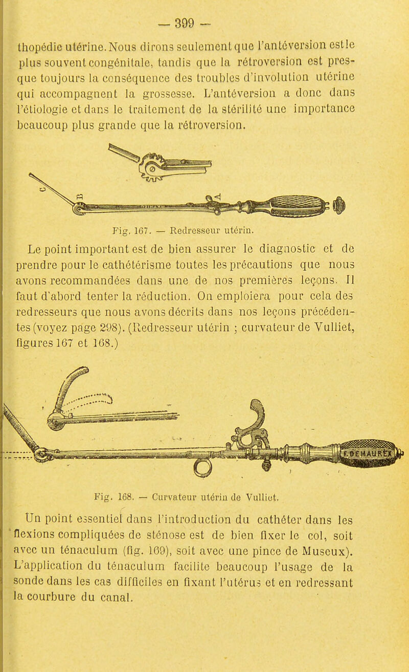 ihopédie utérine. Nous dirons seulement que l'anlcverslon estle plus souvent congénitale, tandis que la rétroversion est pres- que toujours la conséquence des troubles d'involulion utérine qui accompagnent la grossesse. L'antôversion a donc dans l'éliologie et dans le traitement de la stérilité une importance beaucoup plus grande que la rétroversion. Fig, 107. — Redresseur utérin. Le point important est de bien assurer le diagnostic et de prendre pour le cathétérisme toutes les précautions que nous avons recommandées dans une de nos premières leçons. Il faut d'abord tenter la réduction. On emploiera pour cela des redresseurs que nous avons décrits dans nos leçons précéden- tes (voyez page 298). (.Redresseur utérin ; curvateur de Vulliet, figures 167 et 1G8.) Fig. 168. — Curvateur utériu de Vulliot. Un point essentiel dans l'introduction du cathéter dans les 'flexions compliquées de sténose est de bien fixer le col, soit avec un ténaculum (fig. 109), soit avec une pince de iVluseux). L'application du ténaculum facilite beaucoup l'usage de la sonde dans les cas difficiles en fixant l'utérus et en redressant la courbure du canal.