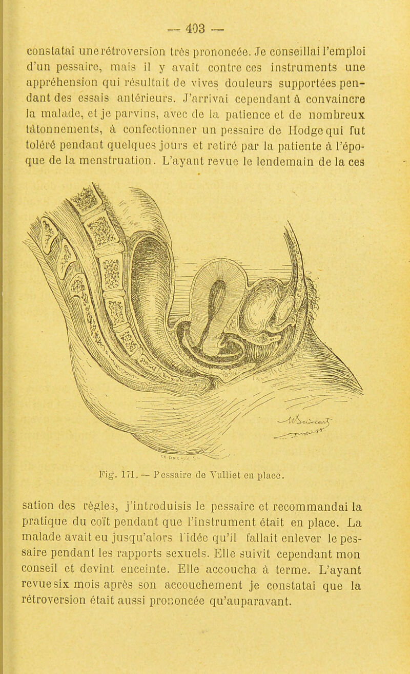 constatai une rétroversion trôs prononcée. Je conseillai l'emploi d'un pessaire, mais il y avait contre ces Instruments une appréhension qui résultait de vives douleurs supportées pen- dant des essais antérieurs. J'arrivai cependant à convaincre la malade, et je parvins, avec de la patience et de nombreux tâtonnements, à confectionner un pessaire de Hodgequi fut toléré pendant quelques jours et retiré par la patiente à l'épo- que de la menstruation. L'ayant revue le lendemain de la ces Fig. 171. — Pessaire de YuUiet eu place. sation des règles, j'introduisis le pessaire et recommandai la pratique du coït pendant que l'instrument était en place. La malade avait eu jusqu'alors l'idée qu'il fallait enlever le pes- saire pendant les rapports sexuels. Elle suivit cependant mon conseil et devint enceinte. Elle accoucha à terme. L'ayant revue six mois après son accouchement je constatai que la rétroversion était aussi prononcée qu'auparavant.