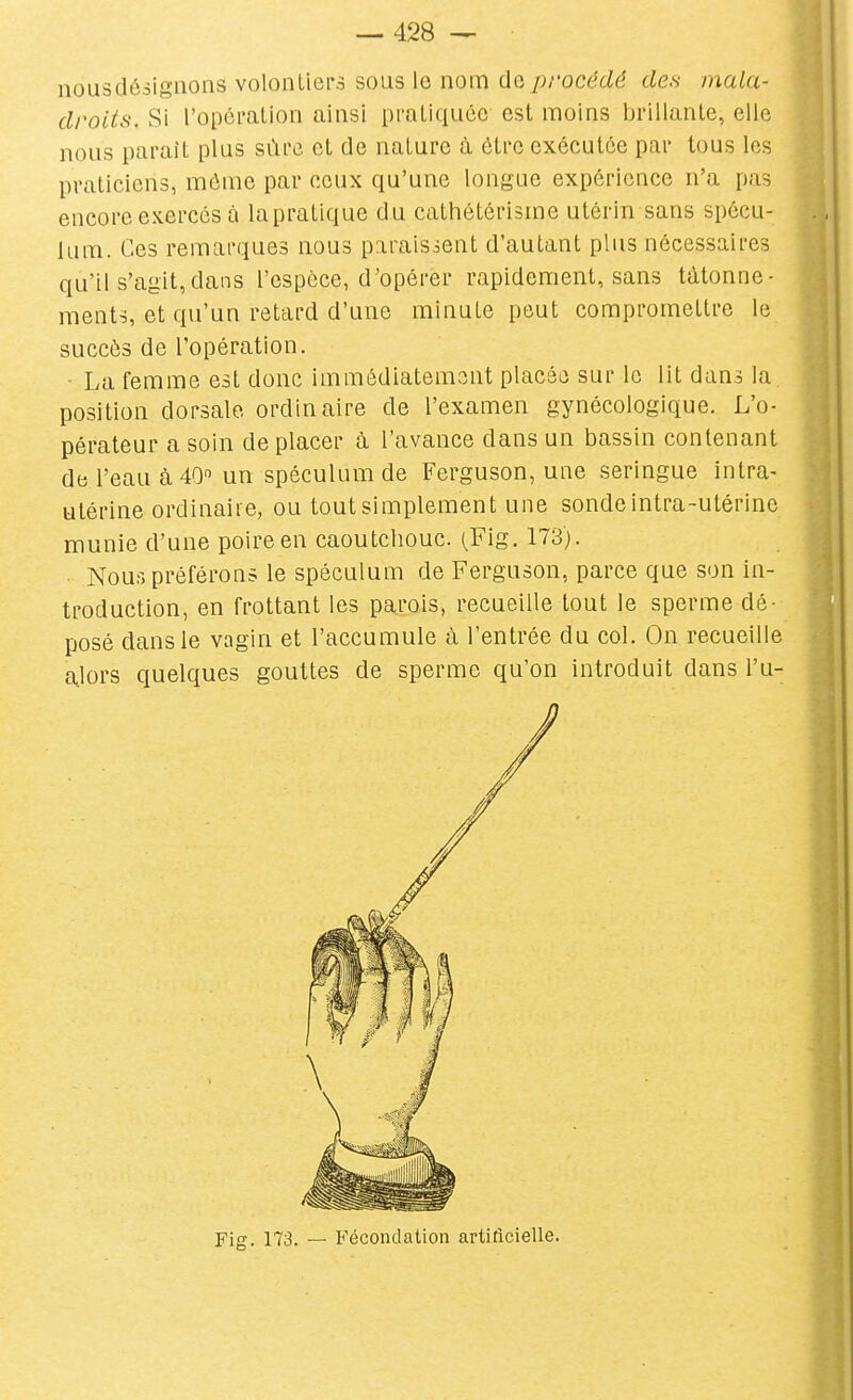 nousdésigiions volontiers sous le nom de procédé des mala- droits. Si ropcmlion ainsi praliquéc est moins brillante, elle nous paraît plus sùrc et de nature à être exécutée par tous les praticiens, môme par ceux qu'une longue expérience n'a pas encore exercés à lapratique du cathôtérisme utérin sans spécu- lum. Ces remarques nous paraissent d'autant plus nécessaires qu'il s'agit,dans l'espôce, d'opérer rapidement, sans tâtonne- ments, et qu'un retard d'une minute peut compromettre le succès de l'opération. - La femme est donc immédiatement placée sur le lit dans la position dorsale ordinaire de l'examen gynécologique. L'o- pérateur a soin de placer à l'avance dans un bassin contenant de l'eau à 40 un spéculum de Ferguson, une seringue intra- utérine ordinaire, ou tout simplement une sonde intra-utérine munie d'une poire en caoutchouc. (^Fig. 173). Nous préférons le spéculum de Ferguson, parce que son in- troduction, en frottant les parois, recueille tout le sperme dé- posé dans le vagin et l'accumule à l'entrée du col. On recueille alors quelques gouttes de sperme qu'on introduit dans l'u- Fig. 173. — B'écondation artificielle.