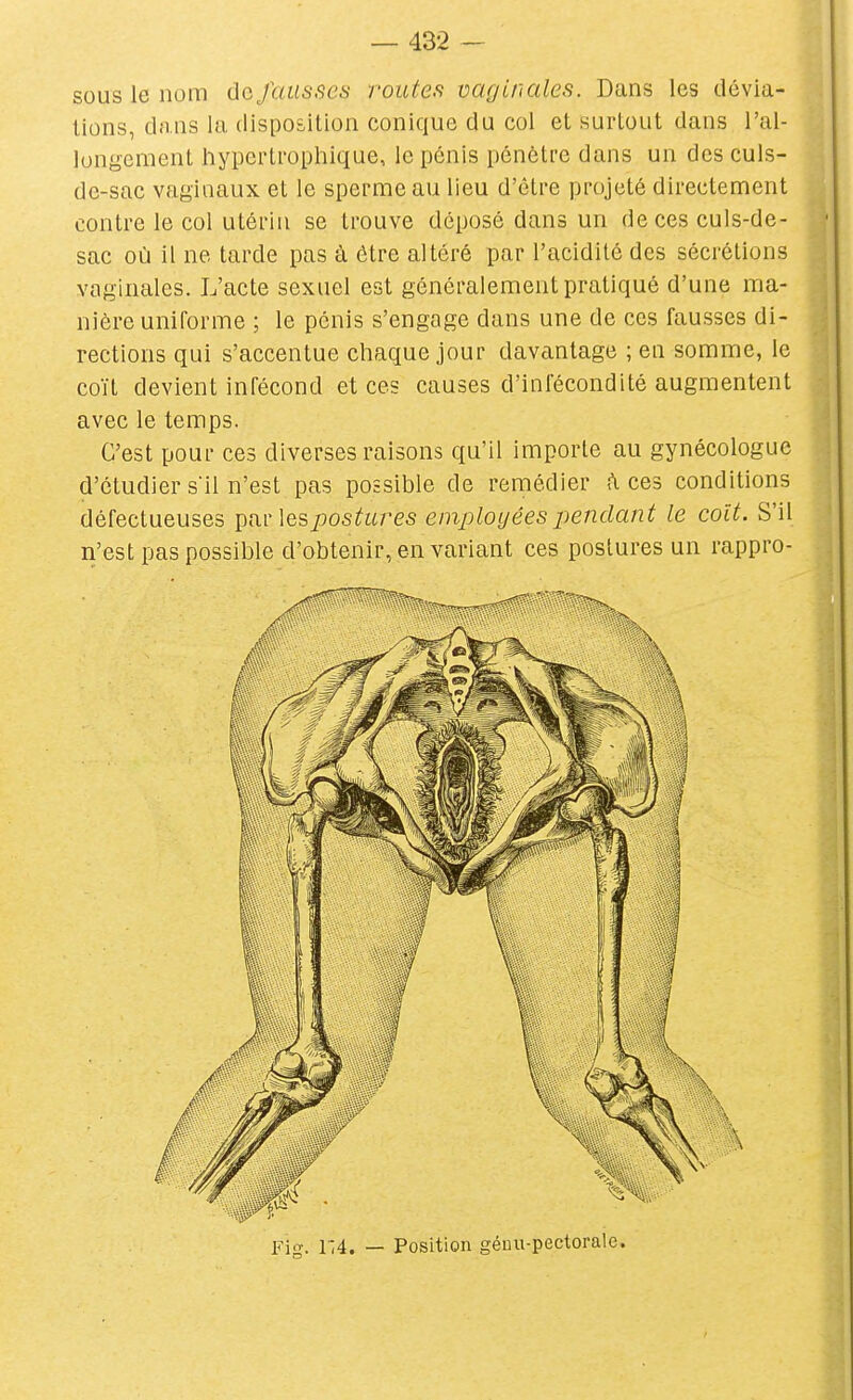 sous le nom de fausses routes vaginales. Dans les dévia- tions, dans la disposition conique du col et surtout dans l'al- longement hypertrophique, le pénis pénètre dans un des culs- de-sac vaginaux et le sperme au lieu d'ôlre projeté directement contre le col utérin se trouve déposé dans un de ces culs-de- sac où il ne tarde pas à être altéré par l'acidité des sécrétions vaginales. L'acte sexuel est généralement pratiqué d'une ma- nière uniforme ; le pénis s'engage dans une de ces fausses di- rections qui s'accentue chaque jour davantage ; en somme, le coït devient infécond et ces causes d'infécondité augmentent avec le temps. C'est pour ces diverses raisons qu'il importe au gynécologue d'étudier s'il n'est pas possible de remédier i\ ces conditions défectueuses par les/ios^ares employées pendant le coït. S'il n'est pas possible d'obtenir, en variant ces postures un rappro-