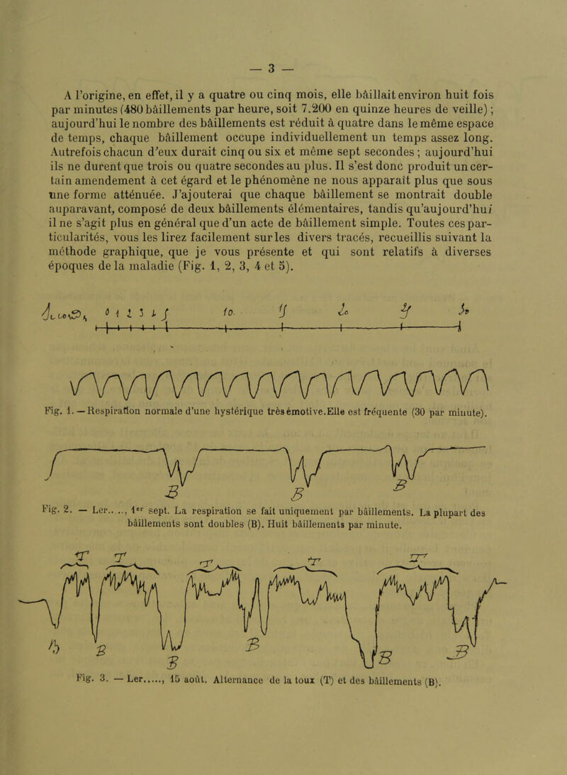 A I’origine, en effet, il y a quatre ou cinq mois, elle ba,illait environ huit fois par minutes f480bS,illeinents par heure, soit 7.200 en quinze heures de veille); aujourd’hui lenombre des bSlillements est r^duit a quatre dans lememe espace de temps, chaque bS,illement occupe individuellement un temps assez long. Autrefois chacun d'’eux durait cinqou six et meme sept secondes; aujourd’hui ils ne durent que trois ou quatre secondes au plus. II s’est done produit uncer- tain amendement k cet egard et le phenomene ne nous apparait plus que sous line forme att^nuee. J’ajouterai que chaque baillement se montrait double auparavant, compose de deux b^illements el6mentaires, tandis qu’aujourd’hui il ne s’agit plus en general qued’un acte de baillement simple. Toutes cespar- ticularites, vous les lirez facilement surles divers traces, recueillis suivant la ni6thode graphique, que je vous pr^sente et qui sont relatifs k diverses epoques de la maladie (Fig. 1, 2, 3, 4 et 5). i 3 J- / /o. tJ 2^ ^ J I I h— 1 1 < i Pig. 1.—Respiration normale d’une hysterique tr^semotive.Elle est frequente (30 par minute). Fig. 2. — Ler.. sept. La respiration se fait uniquement par baillements. La plupart des baillements sont doubles (B). Huit bMllements par minute.