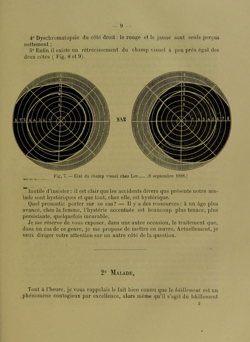 4“ Dyschromatopsie du c6t6 droit: le rouge et le jaune sont seuls percus nettement; 5® Enfin il existe un retrecissement du champ visuel a peu pres ^gal des deux c6tes ( Fig. 8 et 9). Fig. 7. — Elat du champ visuel chez Ler (8 septembre 1888.) Inutile d’insister: il est clairqueies accidents divers que presente notre ma- lade sont hysteriqiies et que tout, chez elle, est hysterique. Quel pronostic porter sur ce cas? — H y a des ressources: k un age plus avance, chez la femme, I’hysterie accentuee est beaucoup plus tenace, plus persistante, quelquefois incurable. Je me reserve de vous exposer, dans une autre occasion, le traitement que, dans un casde ce genre, je me propose de mettre en oeuvre. Actuellement, je veux diriger votre attention sur un autre c6te dela question. 2® Malade. Tout a riieure, je vous rappelais le fait bien connu que le bdillement est un .phenomene contagieux par excellence, alors meme qu’il s’agit du bilillement 2