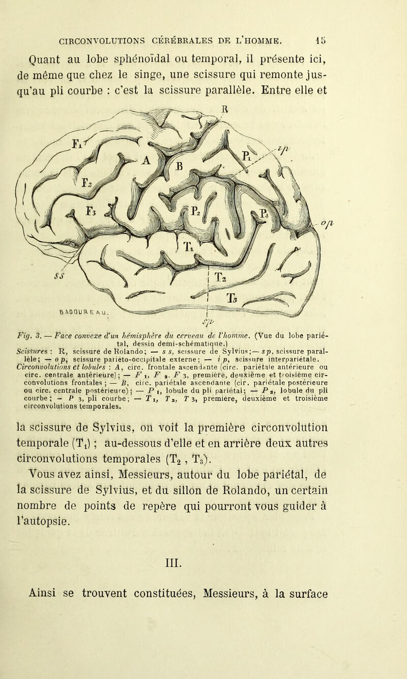 Quant au lobe sphénoïdal ou temporal, il présente ici, de même que chez le singe, une scissure qui remonte jus- qu’au pli courbe : c’est la scissure parallèle. Entre elle et Fig. 3. — Face convexe d'un hémisphère du cerveau de l’homme, (Vue du lobe parié- tal, dessin demi-schématique.) Scissures : R, scissure de Rolande; — s s, scissure de Sylvius;—sp. scissure paral- lèle; — O P, scissure pariéto-occipitale externe; — i p, scissure interpariétale. Circonvolutions et lobules \ A, cire, frontale ascendante (cire, pariétale antérieure ou cire, centrale antérieure); — F \, F F z, première, deuxième et tioi.-ième cir- convolutions frontales;— B. cire, pariétale ascendante (cir. pariétale postérieure ou cire, eentrale postérieure); — P i, lobule du pli pariétal; — P a, lobule du pli eourbe ; - P 3, pli courbe; — T,, Ta, r 3, première, deuxième et troisième circonvolutions temporales. la scissure de Sylvius, on voit la première circonvolution temporale (T^) ; au-dessous d’elle et en arrière deux autres circonvolutions temporales (T2, T3). Vous avez ainsi. Messieurs, autour du lobe pariétal, de la scissure de Sylvius, et du sillon de Rolando, un certain nombre de points de repère qui pourront vous guider à l’autopsie. III. Ainsi se trouvent constituées, Messieurs, à la surface