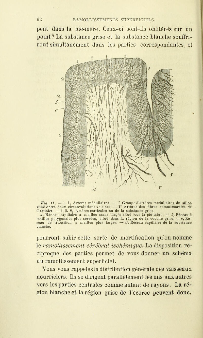 C2 RAMOLLISSEMENTS SUPERFICIELS. pent dans la pie-mère. Ceux-ci sont-ils oblitérés sur un point? La substance grise et la substance blanche souffri- ront simultanément dans les parties correspondantes, et Fig. 11. — 1, 1, Artères médullaires. — 1’ Groupe d'artères médullaires du sillon situé entre deux circonvolutions voisines.— 1 Artères des fibres commissurales de Gratiolet. —2,2. 2, Artères corticales ou de la substance grise. a. Réseau capillaire à mailles assez larges situé sous la pie-mère. — b, Réseau à mailles polygonales plus serrées, situé dans la région de la couche grise. — c. Ré- seau de transition a maiUes plus larges. — d, Réseau capillaire de la substance blanche. pourront subir cette sorte de mortification qu'on nomme le ramollissement cérébral ischémique. La disposition ré- ciproque des parties permet de vous donner un schéma du ramollissement superficiel. Vous vous rappelez la distribution générale des vaisseaux nourriciers. Ils se dirigent parallèlement les uns aux autres vers les parties centrales comme autant de rayons. La ré- gion blanche et la région grise de l’écorce peuvent donc,