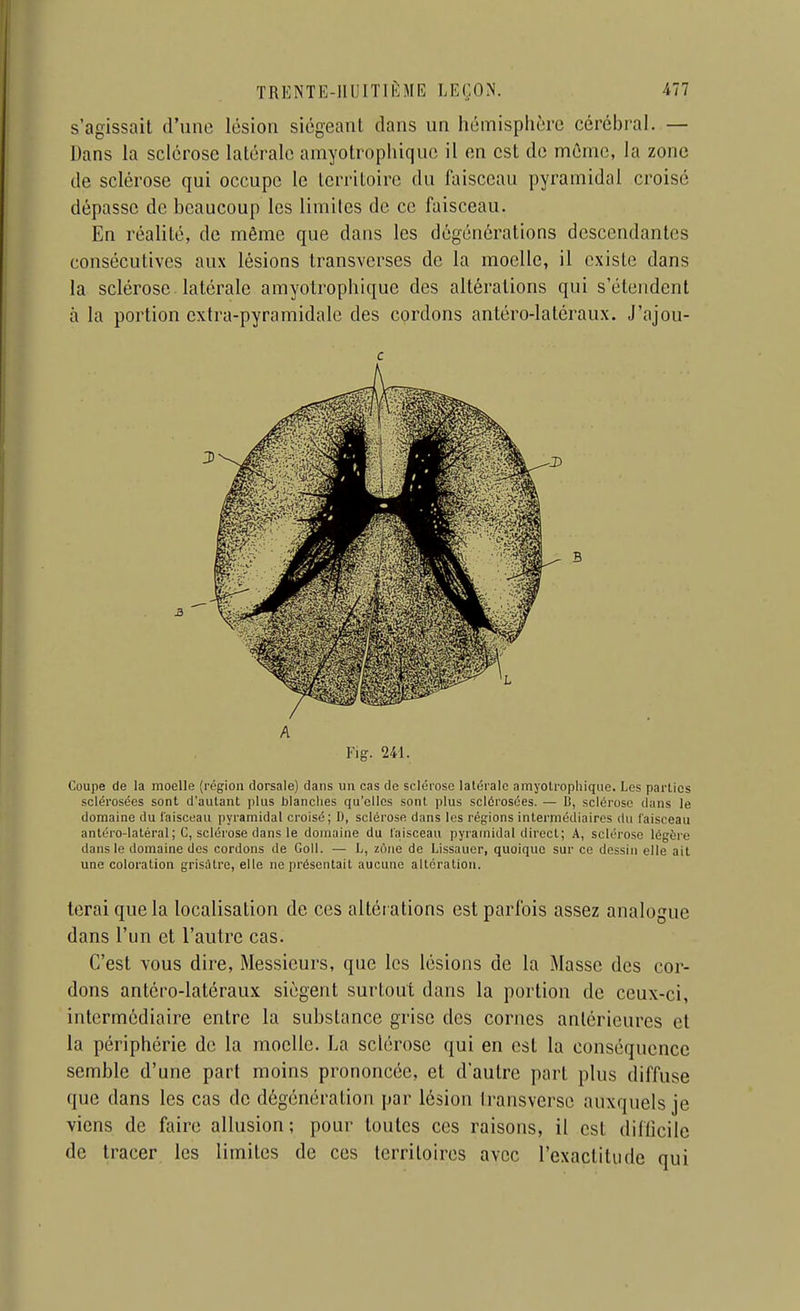 s'agissait d'une lésion siégeant dans un hémisphère cérébral. — Dans la sclérose latérale amyotrophiquc il on est de même, la zone de sclérose qui occupe le territoire du faisceau pyramidal croisé dépasse de beaucoup les limites de ce faisceau. En réalité, de même que dans les dégénérations descendantes consécutives aux lésions transverses de la moelle, il existe dans la sclérose latérale amyotrophiquc des altérations qui s'étendent à la portion extra-pyramidale des cordons antéro-latcraux. J'ajou- c A Fig. 241. Coupe de la moelle (rcgioii dorsale) dans un cas de sclérose latérale amyotrophique. Les parties sclérosées sont d'autant plus blanches qu'elles sont plus sclérosées. — D, sclérose dans le domaine du l'aisceau pyramidal croisé; D, sclérose dans les régions intermédiaires du l'aisceau antéro-latéral; C, sclérose dans le domaine du l'aisceau pyramidal direct; A, sclérose légère dans le domaine des cordons de Coll. — L, ziine de Lissauer, quoique sur ce dessin elle ait une coloration gris;Urc, elle ne présentait aucune altération. terai que la localisation de ces altér ations est parfois assez analogue dans l'un et l'autre cas. C'est vous dire, Messieurs, que les lésions de la Masse des cor- dons antéro-latéraux siègent surtout dans la portion de ceux-ci, intermédiaire entre la substance grise des cornes antérieures et la périphérie de la moelle. La sclérose qui en est la conséquence semble d'une part moins prononcée, et d'autre part plus diffuse que dans les cas de dôgénération par lésion transverse auxquels je viens de faire allusion; pour toutes ces raisons, il est difficile de tracer les limites de ces territoires avec l'exactitude qui