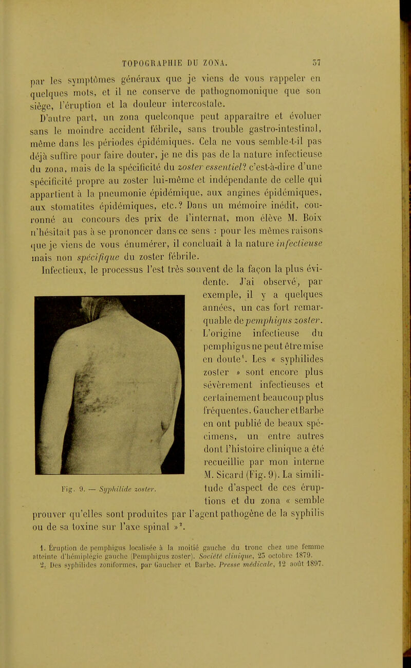 par les symptômes généraux que je viens de vous rappeler en quelques mots, et il ne conserve de pathognomonique que son siège, l'éruption et la douleur intercostale. D'autre part, un zona quelconque peut apparaître et évoluer sans le moindre accident fébrile, sans trouble gastro-intestinal, môme dans les périodes épidémiques. Cela ne vous semblc-t-il pas déjà suffire pour faire douter, je ne dis pas de la nature infectieuse du zona, mais de la spécilicité du zoster essentiel^ c'est-à-diie d'une spéciiicité propre au zosler lui-même et indépendante de celle qui appartient à la pneumonie épidémique, aux angines épidémiques, aux stomatites épidémiques, etc.? Dans un mémoire inédit, cou- ronné au concours des prix de l'internat, mon élève M. Boix n'hésitait pas à se prononcer dans ce sens : pour les mêmes raisons ([ue je viens de vous énumérer, il concluait à la nature infectieuse mais non spécifique du zoster fébrile. Infectieux, le processus l'est très souvent de la façon la plus évi- dente. J'ai observé, par exemple, il y a quelques années, un cas fort remar- quable àepempJiigus zoster. L'origine infectieuse du pcmphigusne peut être mise en doute'. Les « syphilides zosler » sont encore plus sévèrement infectieuses et certainement beaucoup plus fréquentes. Gaucher etBarbe en ont publié de beaux spé- cimens, un entre autres dont l'histoire clinique a été recueillie par mon interne M. Sicard (Fig. 9). La simili- tude d'aspect de ces érup- tions et du zona « semble prouver qu'elles sont produites par l'agent pathogène de la syphilis ou de sa toxine sur l'axe spinal »^ Fig. 9. — SyphUide zosler. 1. Éruption de pemphigus localisée à la moitié gauche du tronc chez une femnio aUeinte d'hémiplégie gauche (Pemphigus zosler). Sncicté clinique, 25 octobre 1S79. 'i. Des syphilides zoniformes, par Gaucher et Barbe. Presxc médicale, 12 août