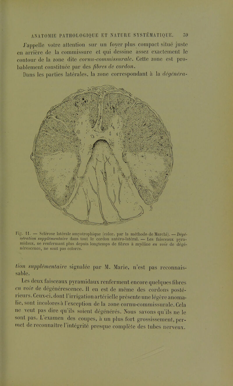 J'appelle voire attention snr un foyer plus compact, situé juste en arrière de la commissure et qui dessine assez exactement le contour de la zone dite cornu-commissurale. Cette zone est pro- bablement constituée par des fibres de cordon. Dans les parties latérales, la zone correspondant à la dégénéra- l'i^î. 11. — Sclérose latérale amyotrophique (color. par la méthode de Marclii).—Bégé- ncration supplémentaire dans tout le cordon antéro-iatéral. — Les faisceaux pyra- midaux, ne renfermant plus depuis longtemps de libres à myéline en voie de dégé- nérescence, ne sont pas colorés. lion supplémentaire signalée par M. Marie, n'est pas reconnais- sable. Les deux faisceaux pyramidaux renferment encore quelques fibres en voie de dégénérescence. Il en est de même des cordons posté- rieurs. Ceux-ci, dont l'irrigation artérielle présente une légère anoma- lie, sont incolores à l'exception delà zone cornu-commissurale. Cela ne veut pas dire qu'ils soient dégénérés. Nous savons qu'ils ne le sont pas. L'examen des coupes, à un plus fort grossissement, per- met de reconnaître l'intégrité presque complète des tubes nerveux.