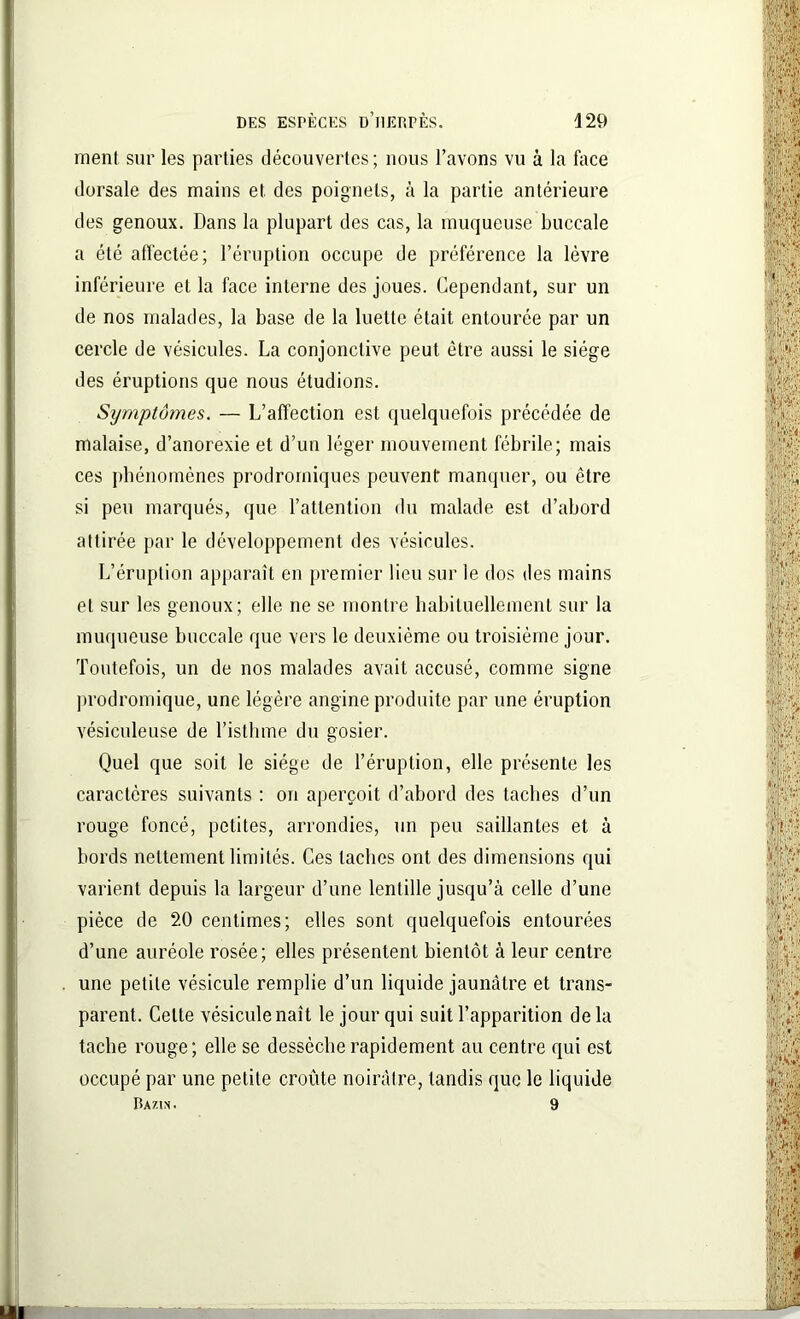 ment sur les parties découvertes ; nous l’avons vu à la lace dorsale des mains et des poignets, à la partie antérieure des genoux. Dans la plupart des cas, la muqueuse buccale a été affectée; l’éruption occupe de préférence la lèvre inférieure et la face interne des joues. Cependant, sur un de nos malades, la base de la luette était entourée par un cercle de vésicules. La conjonctive peut être aussi le siège des éruptions que nous étudions. Symptômes. — L’affection est quelquefois précédée de malaise, d’anorexie et d’un léger mouvement fébrile; mais ces phénomènes prodromiques peuvent manquer, ou être si peu marqués, que l’attention du malade est d’abord attirée par le développement des vésicules. L’éruption apparaît en premier lieu sur le dos des mains et sur les genoux; elle ne se montre habituellement sur la muqueuse buccale que vers le deuxième ou troisième jour. Toutefois, un de nos malades avait accusé, comme signe prodromique, une légère angine produite par une éruption vésiculeuse de l’isthme du gosier. Quel que soit le siège de l’éruption, elle présente les caractères suivants : on aperçoit d’abord des taches d’un rouge foncé, petites, arrondies, un peu saillantes et à bords nettement limités. Ces taches ont des dimensions qui varient depuis la largeur d’une lentille jusqu’à celle d’une pièce de 20 centimes; elles sont quelquefois entourées d’une auréole rosée; elles présentent bientôt à leur centre une petite vésicule remplie d’un liquide jaunâtre et trans- parent. Celte vésicule naît le jour qui suit l’apparition delà tache rouge; elle se dessèche rapidement au centre qui est occupé par une petite croûte noirâtre, tandis que le liquide Bazin. 9 ■MM