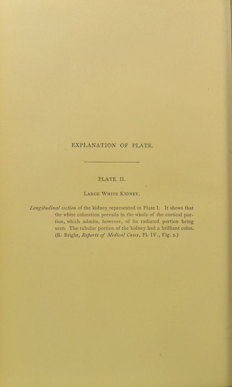 PLATE II. Large White Kidney. Longitudinal section of the kidney represented in Plate I. It shows that the white coloration prevails in the whole of the cortical por- tion, which admits, however, of its radiated portion being seen. The tubular portion of the kidney had a brilliant color. (R. Bright, Reports of Medical Cases, PI. IV., Fig. 2.)