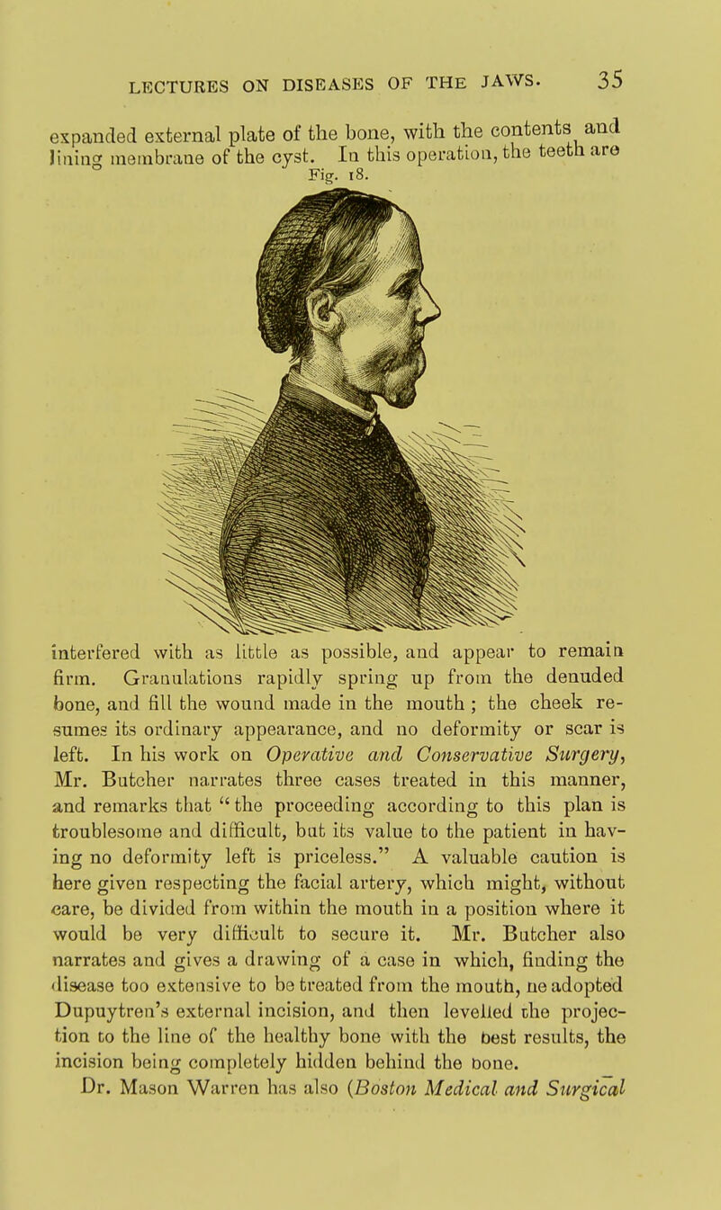 interfered with as little as possible, and appear to remain firm. Graualations rapidly spring up from the denuded bone, and fill the wound made in the mouth ; the cheek re- sumes its ordinary appearance, and no deformity or scar is left. In his work on Operative and Conservative Surgery, Mr. Butcher narrates three cases treated in this manner, and remarks that  the proceeding according to this plan is troublesome and difficult, bat its value to the patient in hav- ing no deformity left is priceless. A valuable caution is here given respecting the facial artery, which might, without care, be divided from within the mouth in a position where it would be very difficult to secure it. Mr. Butcher also narrates and gives a drawing of a case in which, finding the disease too extensive to be treated from the mouth, ne adopted Dupuytren's external incision, and then levelled che projec- tion to the line of the healthy bone with the best results, the incision being completely hidden behind the bone. Dr. Mason Warren has also {Boston Medical and Surgical