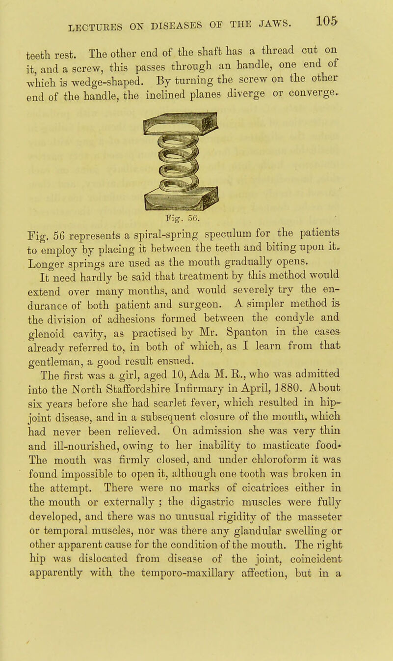 teeth rest. The other end of the shaft has a thread cut on it, and a screw, this passes through an handle, one end of which is wedge-shaped. By turning the screw on the other end of the handle, the inclined planes diverge or converge. Fig. 56. Fig. 56 represents a spiral-spring speculum for the patients to employ by placing it between the teeth and biting upon it. Longer springs are used as the mouth gradually opens. It need hardly be said that treatment by this method would extend over many months, and would severely try the en- durance of both patient and surgeon. A simpler method i& the division of adhesions formed between the condyle and glenoid cavity, as practised by Mr. Spanton in the cases already referred to, in both of which, as I learn from that gentleman, a good result ensued. The first was a girl, aged 10, Ada M. R., who was admitted into the North Staffordshire Infirmary in April, ] 880. About six years before she had scarlet fever, which resulted in hip- joint disease, and in a subsequent closure of the mouth, which had never been relieved. On admission she was very thin and ill-nourished, owing to her inability to masticate food* The mouth was firmly closed, and under chloroform it was found impossible to open it, although one tooth was broken in the attempt. There were no marks of cicatrices either in the mouth or externally ; the digastric muscles were fully developed, and there was no unusual rigidity of the masseter or temporal muscles, nor was there any glandular swelling or other apparent cause for the condition of the mouth. The right hip was dislocated from disease of the joint, coincident apparently with the temporo-maxillary affection, but in a