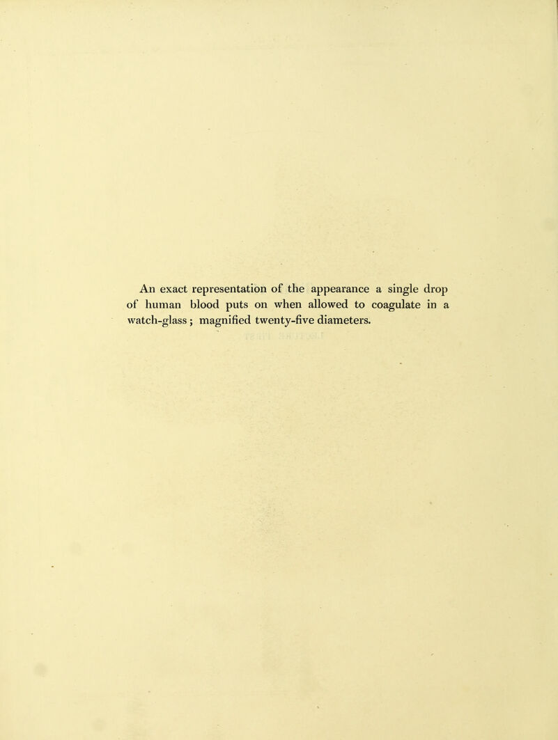 An exact representation of the appearance a single drop of human blood puts on when allowed to coagulate in a watch-glass; magnified twenty-five diameters.