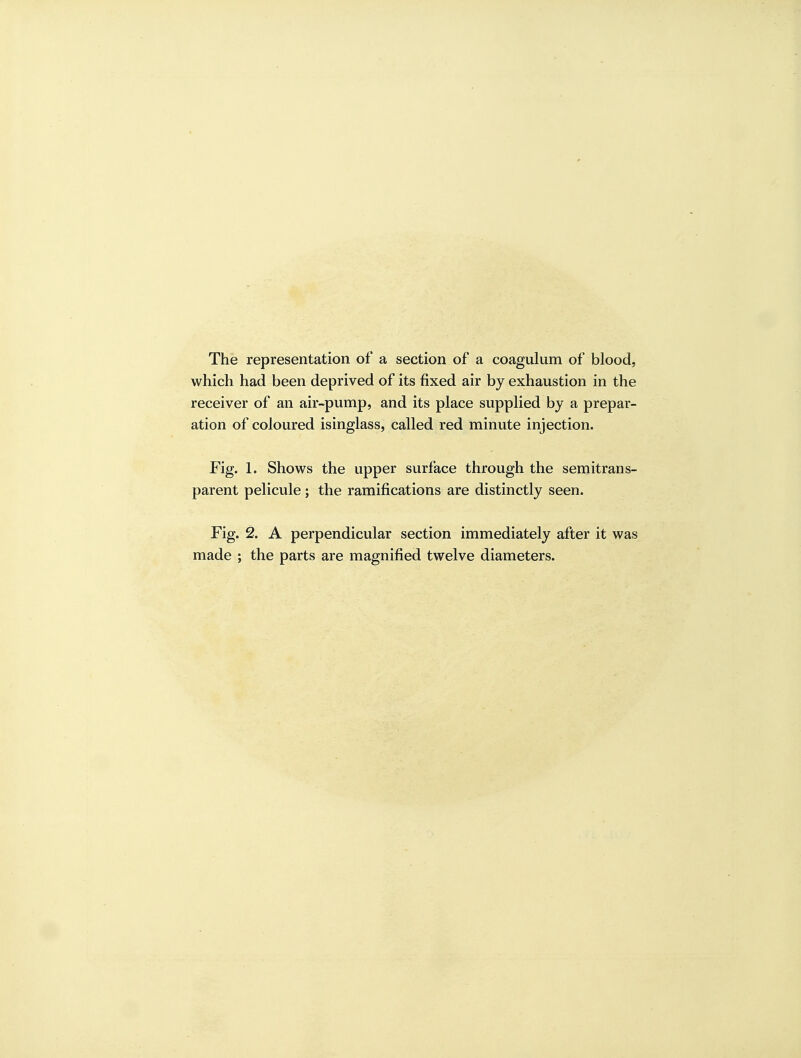 The representation of a section of a coagulum of blood, which had been deprived of its fixed air by exhaustion in the receiver of an air-pump, and its place supplied by a prepar- ation of coloured isinglass, called red minute injection. Fig. 1. Shows the upper surface through the senaitrans- parent pelicule; the ramifications are distinctly seen. Fig. 2. A perpendicular section immediately after it was made ; the parts are magnified twelve diameters.