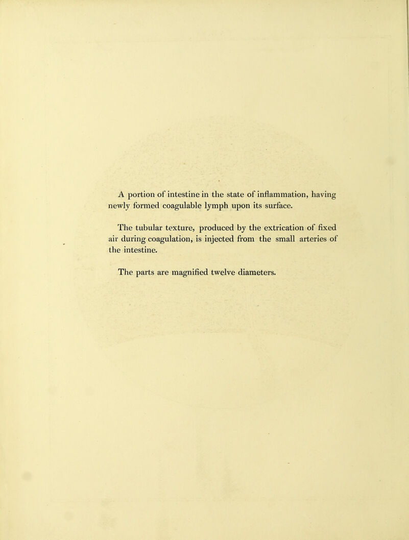 A portion of intestine in the state of inflammation, having newly formed coagulable lymph upon its surface. The tubular texture, produced by the extrication of fixed air during coagulation, is injected from the small arteries of the intestine.