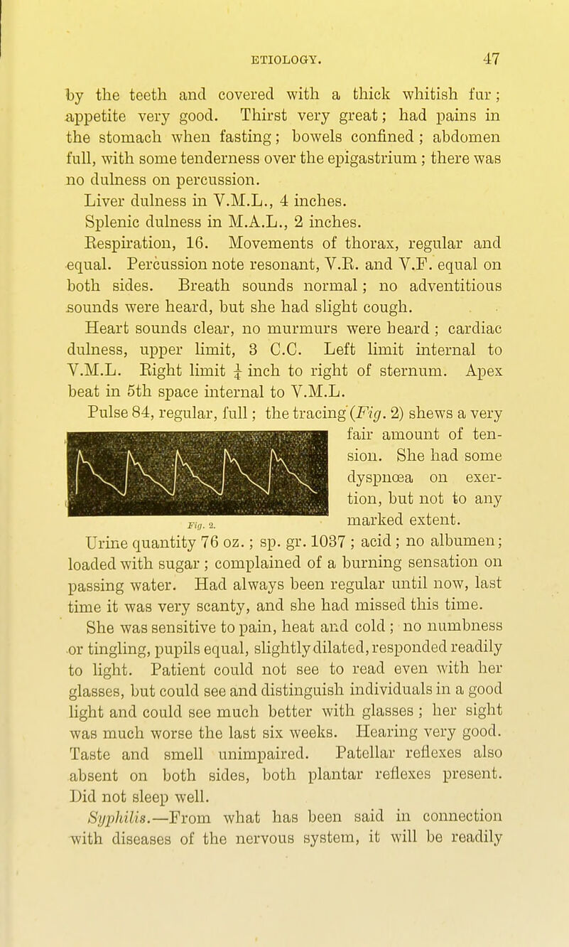 by the teeth and covered with a thick whitish fur; appetite very good. Thirst very great; had pains in the stomach when fasting; bowels confined ; abdomen full, with some tenderness over the epigastrium; there was no dulness on percussion. Liver dulness in V.M.L., 4 inches. Splenic dulness in M.A.L., 2 inches. Eespiration, 16. Movements of thorax, regular and equal. Percussion note resonant, V.E. and V.F. equal on both sides. Breath sounds normal; no adventitious sounds were heard, but she had slight cough. Heart sounds clear, no murmurs were beard ; cardiac dulness, upper limit, 3 C.C. Left limit internal to V.M.L. Eight limit J inch to right of sternum. Apex beat in 5th space internal to V.M.L. Pulse 84, regular, full; the tracing (Fig. 2) shews a very fair amount of ten- sion. She had some dyspnoea on exer- tion, but not to any marked extent. Urine quantity 76 oz.; sp. gr. 1037 ; acid; no albumen; loaded with sugar ; complained of a burning sensation on passing water. Had always been regular until now, last time it was very scanty, and she had missed this time. She was sensitive to pain, heat and cold; no numbness or tingling, pupils equal, slightly dilated, responded readily to light. Patient could not see to read even with her glasses, but could see and distinguish individuals in a good light and could see much better with glasses ; her sight was much worse the last six weeks. Hearing very good. Taste and smell unimpaired. Patellar reflexes also absent on both sides, both plantar reflexes present. Did not sleep well. Syphilis.—From what has been said in connection with diseases of the nervous system, it will be readily