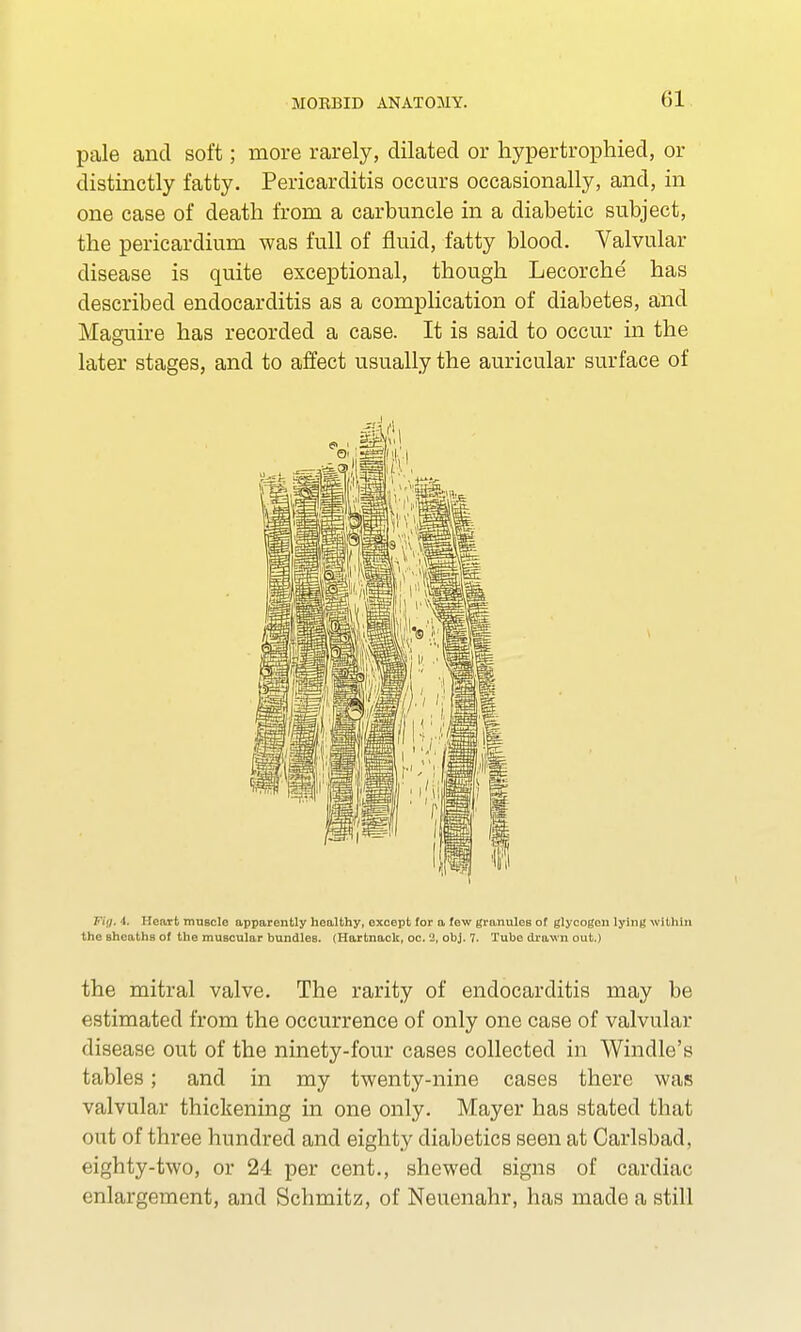 (51 pale and soft; more rarely, dilated or hypertrophied, or distinctly fatty. Pericarditis occurs occasionally, and, in one case of death from a carbuncle in a diabetic subject, the pericardium was full of fluid, fatty blood. Valvular disease is quite exceptional, though Lecorche has described endocarditis as a complication of diabetes, and Maguire has recorded a case. It is said to occur in the later stages, and to affect usually the auricular surface of fflg. 1. Heart muscle apparently healthy, except for a few granules of glycogen lying within the sheaths of the muscular bundles. (Hartnack, oc. l2, obj. 7. Tube drawn out.) the mitral valve. The rarity of endocarditis may be estimated from the occurrence of only one case of valvular disease out of the ninety-four cases collected in Windle's tables; and in my twenty-nine cases there was valvular thickening in one only. Mayer has stated that out of three hundred and eighty diabetics seen at Carlsbad, <;i^hty-two, or 24 per cent., shewed signs of cardiac enlargement, and Schmitz, of Neuenahr, has made a still