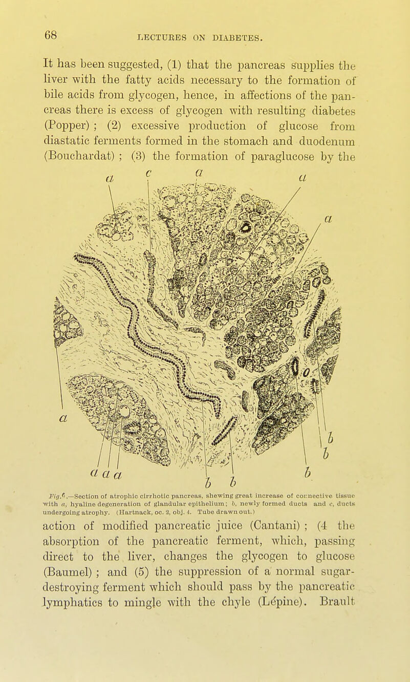 It has been suggested, (1) that the pancreas supplies the liver with the fatty acids necessary to the formation of bile acids from glycogen, hence, in affections of the pan- creas there is excess of glycogen with resulting diabetes (Popper) ; (2) excessive production of glucose from diastatic ferments formed in the stomach and duodenum (Bouchardat) ; (3) the formation of paraglucose by the Fi(i/> .—Section of atrophic cirrhotic pancreas, shewing great increase of connective Ubsuo with a, hyaline degeneration of glandular epithelium; !), newly formed ducts and c, ducts undergoing atrophy. (Hartnack, oc. 2, obj. i. Tube drawn out.) action of modified pancreatic juice (Cantani) ; (4 the absorption of the pancreatic ferment, which, passing direct to the liver, changes the glycogen to glucose (Baumel); and (5) the suppression of a normal sugar- destroying ferment which should pass by the pancreatic lymphatics to mingle with the chyle (Lepine). Brault