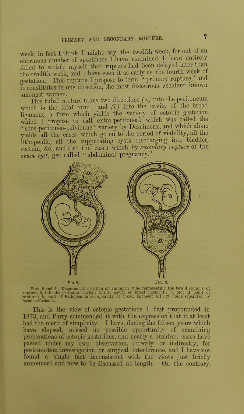 week, in fact I think I might say the twelfth week, for out of an enormous number of specimens I have examined I haye entirely failed to satisfy myself that rapture had been delayed later than the twelfth week, and I have seen it as early as the fourth week of gestation. This rapture I propose to term  primary rupture,' and it constitutes in one direction, the most disastrous accident known amongst women. This tubal rupture takes two directions (a) into the peritoneum which is the fatal form; and (b) into the cavity of the broad ligament, a form which yields the variety of ectopic gestation which I propose to call extra-peritoneal which was called the  sous-peritoneo-pelvienne  variety by Dezeimeris, and which alone yields all the cases which go on to the period of viability, all the lithopoedia, all the suppurating cysts discharging into bladder, rectum, &c, and also the cases which by secondary rupture of the ovum cyst, get called  abdominal pregnancy. Fio 2. Fio. 3. Fios. 2 and 3.—Diagrammatic section of Fallopian tul>e representing the two directions ol rapture, 2, into the peritoneal cavity ; 3, into cavity of broad ligament; a, clot at point of rupture; h, wall of Fallopian tube; c, cavity of broad ligament with (3) folds separated by luemic effusion a. This is the view of ectopic gestations I first propounded in 1873, and Parry commended it with the expression that it at least had the merit of simplicity. I have, during the fifteen years which have elapsed, missed no possible opportunity of examining preparations of ectopic gestations, and nearly a hundred cases have passed under my own observation, directly or indirectly, for post-mortem investigation or surgical interference, and I have not found a single fact inconsistent with the views just briefly announced and now to be discussed at length. On the contrary,