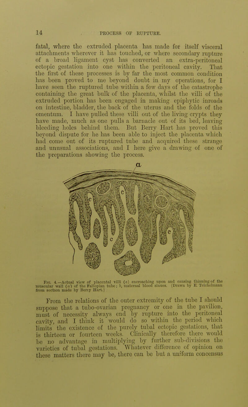 fatal, where the extruded placenta has made for itself visceral attachments wherever it has touched, or where secondary rupture of a broad ligament cyst has converted an extra-peritoneal ectopic gestation into one within the peritoneal cavity. That the first of these processes is by far the most common condition has been proved to me beyond doubt in my operations, for I have seen the ruptured tube within a few days of the catastrophe containing the great bulk of the placenta, whilst the villi of the extruded portion has been engaged in making epiphytic inroads on intestine, bladder, the back of the uterus and the folds of the omentum. I have pulled these villi out of the living crypts they have made, much as one pulls a barnacle out of its bed, leaving bleeding holes behind them. But Berry Hart has proved this beyond dispute for he has been able to inject the placenta which had come out of its ruptured tube and acquired these strange and unusual associations, and I here give a drawing of one of the preparations showing the process. Fig. 4.—Actual view of placental villi (c) encroaching upon and causing thinning of the muscular wall (a) of the Fallopian tube; &, maternal blood sinues. (Drawn by E. Teichelinanu from section made by Beny Hart.) From the relations of the outer extremity of the tube I should suppose that a tubo-ovarian pregnancy or one in the pavilion, must of necessity always end by rupture into the peritoneal cavity, and I think it would do so within the period which limits the existence of the purely tubal ectopic gestations, that is thirteen or fourteen weeks. Clinically therefore there would be no advantage in multiplying by further sub-divisions the varieties of tubal gestations. Whatever difference of opinion on these matters there may be, there can be but a uniform concensus