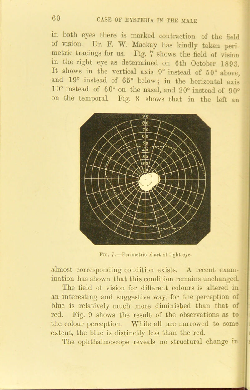 in both eyes there is marked contraction of the field oi vision. Dr. F. W. Mackay has kindly taken peri- metric tracings for us. Fig. 7 shows the field of vision in the right eye as determined on 6th October 1893. It shows in the vertical axis 9° instead of 50° above, and 19° instead of 65° below; in the horizontal axis 10° instead of 60° on the nasal, and 20° instead of 90° on the temporal. Fig. 8 shows that in the left an Fig. 7.—Perimetric chart of right eye. almost corresponding condition exists. A recent exam- ination has shown that this condition remains unchanged. The field of vision for different colours is altered in an interesting and suggestive way, for the perception of blue is relatively much more diminished than that of red. Fig. 9 shows the result of the observations as to the colour perception. While all are narrowed to some extent, the blue is distinctly less than the red. The ophthalmoscope reveals no structural change in