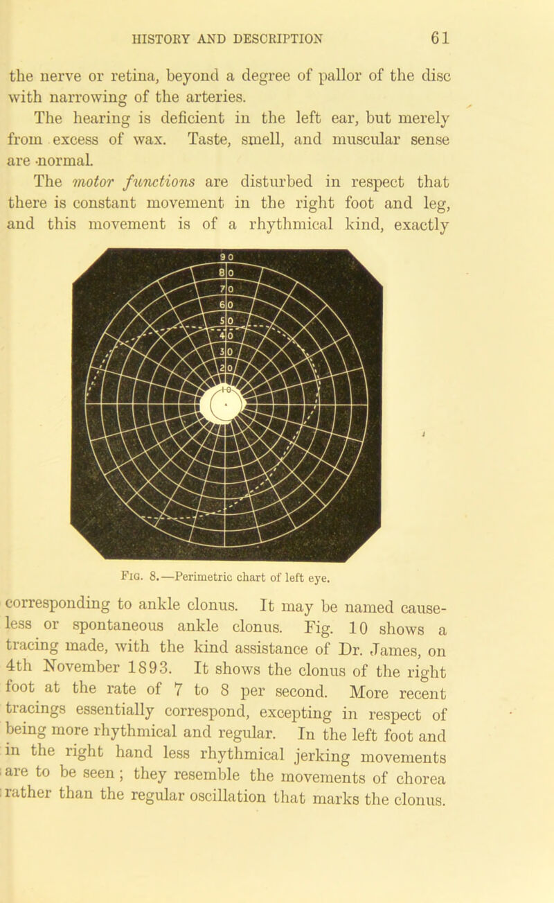 the nerve or retina, beyond a degree of pallor of the disc with narrowing of the arteries. The hearing is deficient in the left ear, but merely from excess of wax. Taste, smell, and muscular sense are -normal. The motor functions are disturbed in respect that there is constant movement in the right foot and leg, and this movement is of a rhythmical kind, exactly Fig. 8.—Perimetric chart of left eye. corresponding to ankle clonus. It may be named cause- less or spontaneous ankle clonus. Fig. 10 shows a tracing made, with the kind assistance of Dr. James, on 4th November 1893. It shows the clonus of the right toot at the rate of 7 to 8 per second. More recent tracings essentially correspond, excepting in respect of being more rhythmical and regular. In the left foot and in the right hand less rhythmical jerking movements 1 are t0 be seen i they resemble the movements of chorea ; rather than the regular oscillation that marks the clonus.