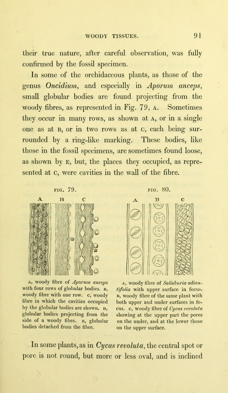 their true nature, after careful observation, was fully confirmed by the fossil specimen. In some of the orchidaceous plants, as those of the genus Oncidium, and especially in Aporum anceps, small globular bodies are found projecting from the woody fibres, as represented in Fig. 79, a. Sometimes they occur in many rows, as shown at a, or in a single one as at b, or in two rows as at c, each being sur- rounded by a ring-like marking. These bodies, like those in the fossil specimens, are sometimes found loose, as shown by e, but, the places they occupied, as repre- sented at c, were cavities in the wall of the fibre. FIG. 79. ABC A, woody fibre of Aporum ayiceps with four rows of globular bodies, b, woody fibre with one row. c, woody fibre in which the cavities occupied by the globular bodies are shown, d, globular bodies projecting from the side of a woody fibre, e, globular bodies detached from the fibre. FIG. 80. A B C A, woody fibre of Salisburia adiau- tifolia with upper surface in focus. B, woody fibre of the same plant with both upper and under siu'faces in fo- cus. c, woody fibre of Cycas revoluta showing at the upper part the pores on the under, and at the lower those on the upper surface. In some plants, as in Cycas revoluta, the central spot or pore is not round, but more or less oval, and is inclined