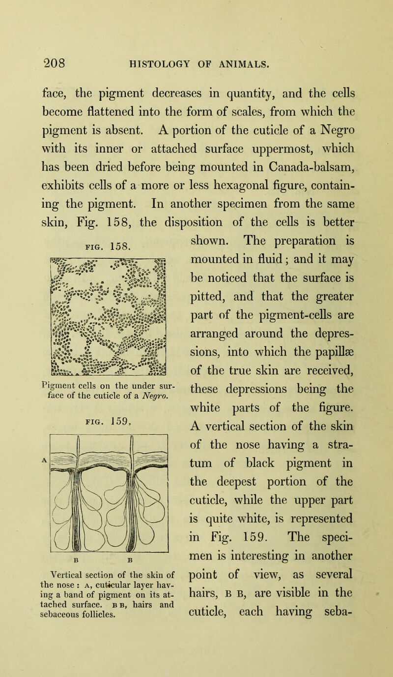 FIG. 158. •i* ;.* .tfiS ' “tv 1 face, the pigment decreases in quantity, and the cells become flattened into the form of scales, from which the pigment is absent. A portion of the cuticle of a Negro with its inner or attached surface uppermost, which has been dried before being mounted in Canada-balsam, exhibits cells of a more or less hexagonal figure, contain- ing the pigment. In another specimen from the same skin. Fig. 158, the disposition of the cells is better shown. The preparation is mounted in fluid ; and it may be noticed that the surface is pitted, and that the greater part of the pigment-cells are arranged around the depres- sions, into which the papillae of the true skin are received, these depressions being the white parts of the figure. A vertical section of the skin of the nose having a stra- tum of black pigment in the deepest portion of the cuticle, while the upper part is quite white, is represented in Fig. 159. The speci- men is interesting in another Vertical section of the skin of point of vieW, aS Several the nose: a, cuticular layer hav- . ing a band of pigment on its at- hairS, B B, are Visible in the tached surface, b b, hairs and ,. i i • i sebaceous follicles. cuticle, each having seba- ft. • yy.v;-.. ..ff '• Pigment cells on the under sur- face of the cuticle of a Negro.