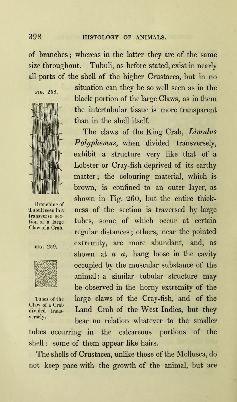 fig. 258. of branches; whereas in the latter they are of the same size throughout. Tubuli, as before stated, exist in nearly all parts of the shell of the higher Crustacea, hut in no situation can they be so well seen as in the black portion of the large Claws, as in them the intertubular tissue is more transparent than in the shell itself. The claws of the King Crab, Limulus Polyphemus, when divided transversely, exhibit a structure very like that of a Lobster or Cray-fish deprived of its earthy matter; the colouring material, which is brown, is confined to an outer layer, as shown in Fig. 260, but the entire thick- ness of the section is traversed by large tubes, some of which occur at certain regular distances; others, near the pointed extremity, are more abundant, and, as shown at a a, hang loose in the cavity occupied by the muscular substance of the animal: a similar tubular structure may be observed in the horny extremity of the large claws of the Cray-fish, and of the Land Crab of the West Indies, but they bear no relation whatever to the smaller tubes occurring in the calcareous portions of the shell: some of them appear like hairs. The shells of Crustacea, unlike those of the Mollusca, do not keep pace with the growth of the animal, but are Branching of Tubuli seen in a transverse sec- tion of a large Claw of a Crab. fig. 259. Tubes of the Claw of a Crab divided trans- versely.