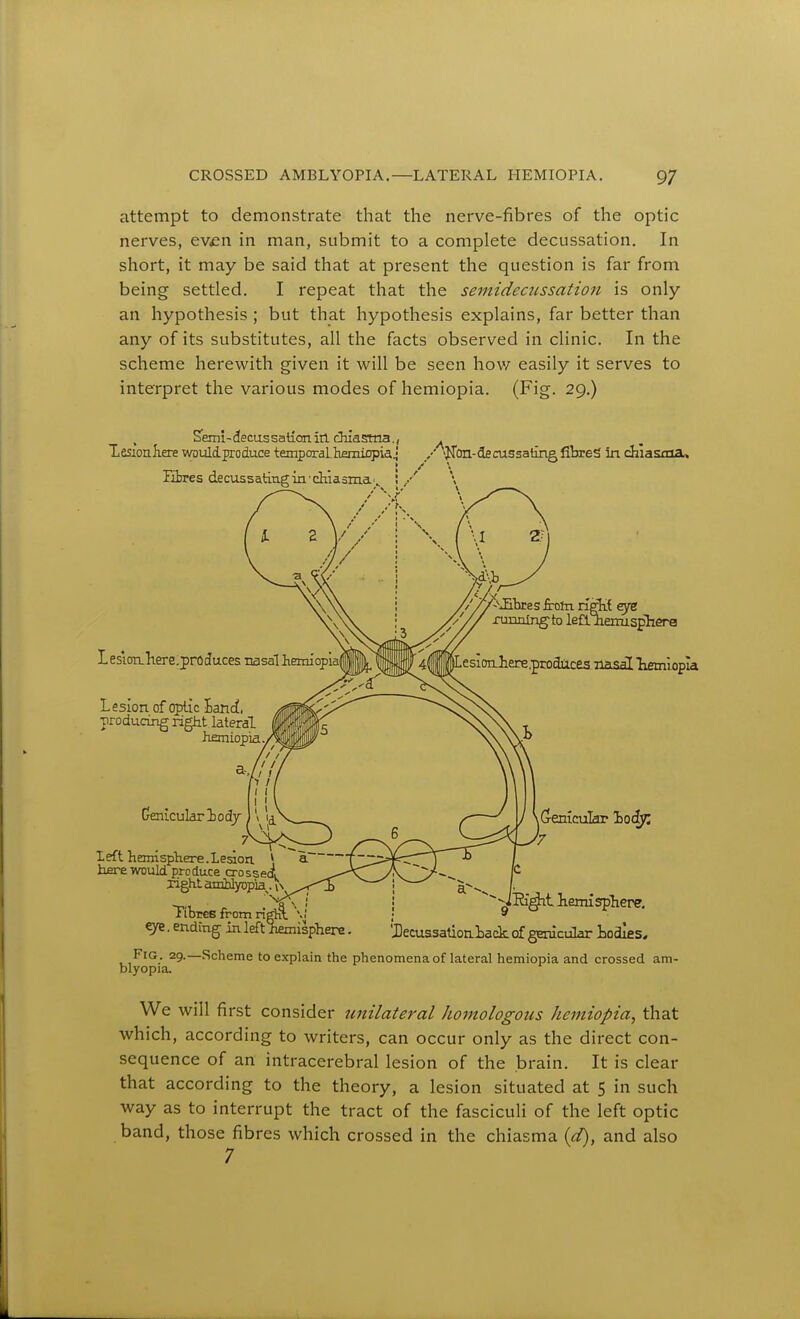 attempt to demonstrate that the nerve-fibres of the optic nerves, ev^n in man, submit to a complete decussation. In short, it may be said that at present the question is far from being settled. I repeat that the semidecussation is only an hypothesis ; but that hypothesis explains, far better than any of its substitutes, all the facts observed in clinic. In the scheme herewith given it will be seen hov/ easily it serves to interpret the various modes of hemiopia. (Fig. 29.) Sfemi-demssalionin chiasftna, Xesionliere would produce temporalhemiDpia Fibres decussating in'chiasma'.. L esion.liere;pr(lduces nasal iemiopiai Lesion of ojjtic Band, producing right lateral honiopia. Genicular lodj ' —f left hemisphere.Le^on \ a hfire would produce crosseci Tight anfhlyopia^. in^i TibreB from rigl^ '\\ eye. ending in left liemisphere >jTon-decussating fibres in chiasma. running'to lealieniisphera iLesionJiere.pmdiices nasal liemiopia ^Jihres frotn n&{ eye (jenicukr 'hoc^ '7 Fig. 29.—Scheme to explain blyopia. ^JK^t liemisphere. 'Decussationtack. of genicular Lodles* the phenomena of lateral hemiopia and crossed am- We will first consider unilateral homologous hemiopia, that which, according to writers, can occur only as the direct con- sequence of an intracerebral lesion of the brain. It is clear that according to the theory, a lesion situated at $ in such way as to interrupt the tract of the fasciculi of the left optic band, those fibres which crossed in the chiasma {d), and also 7