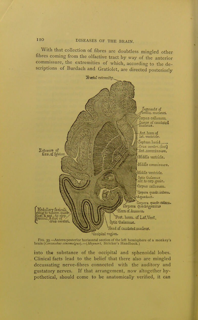 With that collection of fibres are doubtless mingled other fibres coming from the olfactive tract by way of the anterior commissure, the extremities of which, according to the de- scriptions of Burdach and Gratiolet, are directed posteriorly ^Ebonlal extremity^ Entrance of Css.of Sylvius. MedullaiT.l Lube ^ fasiculi. going to tuberc.quadr. P.&Lanl.;to corp cul..&foot of ' 'crus cerebn Segments' of ''.enlic. nucleus. Corpus callosum. yo. Queue of caudatecl i^Tiucleus. Ant. horn o£ lat. ventricle, ■Septum lucid . Crus cerebn. (foot) ^~Ant .commissuFe, -Middle ventricle. 'Ifddle commissure. j.iiddle ventricle. Optic thalamus ant.to corp.genie. Corpus callosum. -srpora cjuadrJntenu //& Corpora quadr. extECa. l^S^'fC^ Corpora quadrigemina ^!?.i5jviyNjfom k. Ainiuoji, ^Post.hom.ofLat.Vent. Dptic thalamus. Head of caudated nucleus. ' Occipital region.. Fig. 33.—Antero-posterior horizontal section of the left hemisphere of a monkey's bxTiva^Cercocebus cinomolffiis).—{Meynert, Strieker's Handbook.) into the substance of the occipital and sphenoidal lobes. Clinical facts lead to the belief that there also are mingled decussating nerve-fibres connected with the auditory and gustatory nerves. If that arrangement, now altogether hy- pothetical, should come to be anatomically verified, it can