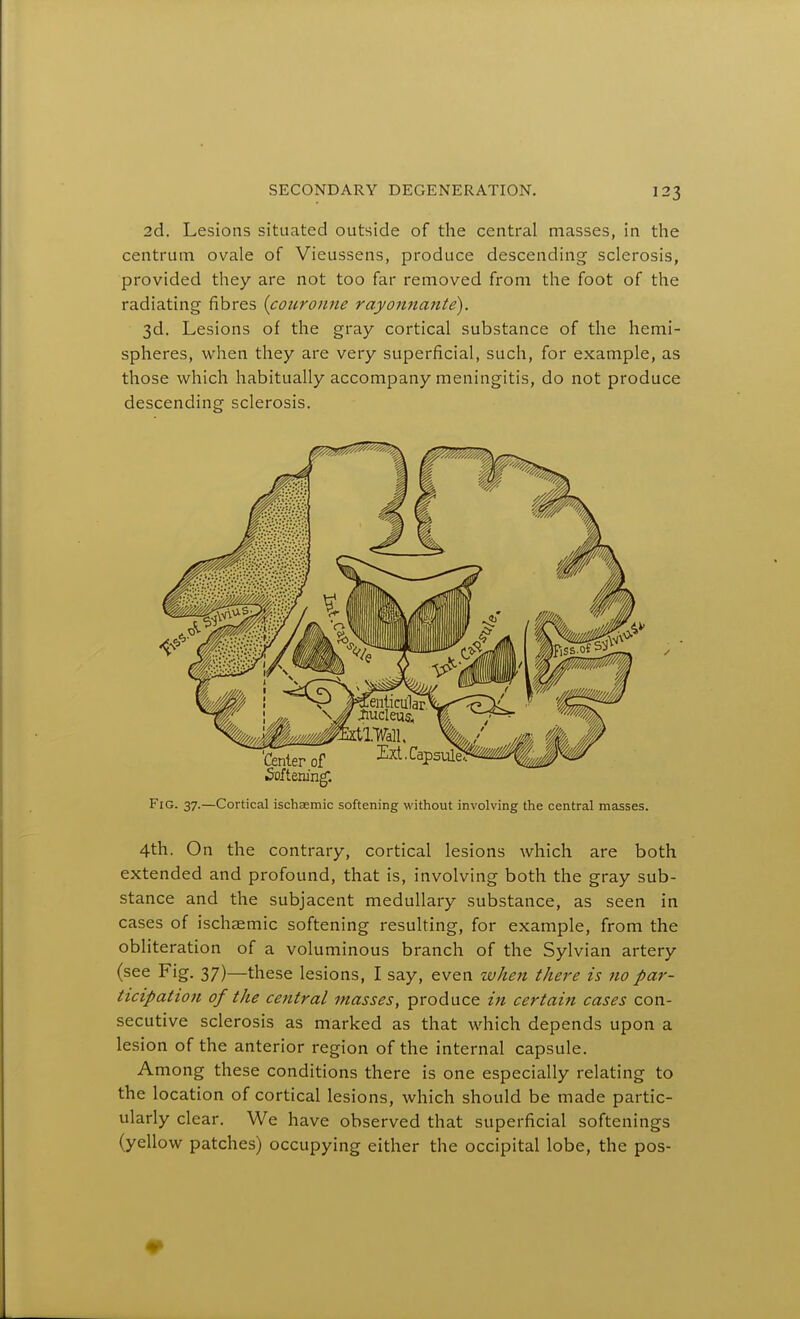 2d. Lesions situated outside of the central masses, in the centrum ovale of Vieussens, produce descending sclerosis, provided they are not too far removed from the foot of the radiating fibres {couronne rayojinajite). 3d. Lesions of the gray cortical substance of the hemi- spheres, when they are very superficial, such, for example, as those which habitually accompany meningitis, do not produce descending sclerosis. Fig. 37.—Cortical ischaemic softening without involving the central masses. 4th. On the contrary, cortical lesions which are both extended and profound, that is, involving both the gray sub- stance and the subjacent medullary substance, as seen in cases of ischaemic softening resulting, for example, from the obliteration of a voluminous branch of the Sylvian artery (see Fig. 37)—these lesions, I say, even when there is no par- ticipation of the central masses, produce in certain cases con- secutive sclerosis as marked as that which depends upon a lesion of the anterior region of the internal capsule. Among these conditions there is one especially relating to the location of cortical lesions, which should be made partic- ularly clear. We have observed that superficial softenings (yellow patches) occupying either the occipital lobe, the pos-