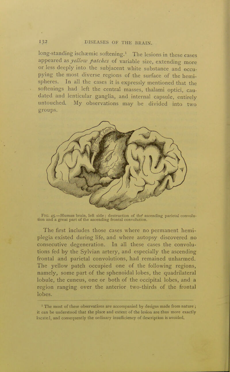 long-standing ischaemic softening.^ The lesions in these cases appeared as yellozv patches of variable size, extending more or less deeply into the subjacent white substance and occu- pying the most diverse regions of the surface of the hemi- spheres. In all the cases it is expressly mentioned that the softenings had left the central masses, thalami optici, cau- dated and lenticular ganglia, and internal capsule, entirely untouched. My observations may be divided into two groups. Fig. 45.—Human brain, left side ; destruction of the< ascending parietal convolu- tion and a great part of the ascending frontal convolution. The first includes those cases where no permanent hemi- plegia existed during life, and where autopsy discovered no consecutive degeneration. In all these cases the convolu- tions fed by the Sylvian artery, and especially the ascending frontal and parietal convolutions, had remained unharmed. The yellow patch occupied one of the following regions, namely, some part of the sphenoidal lobes, the quadrilateral lobule, the cuneus, one or both of the occipital lobes, and a region ranging over the anterior two-thirds of the frontal lobes. ' The most of these observations are accompanied by designs made from nature ; it can be understood that the place and extent of the lesion are thus more exactly located, and consequently the ordinary insufficiency of description is avoided.