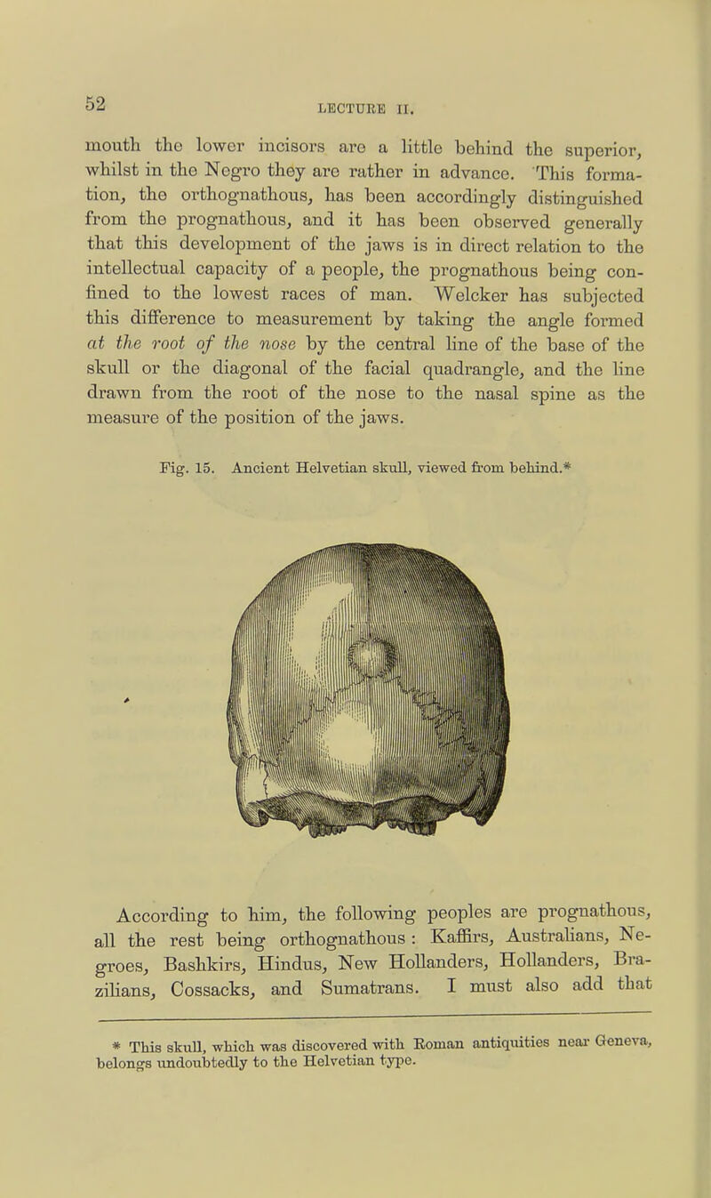 mouth the lower incisors are a little behind the superior, whilst in the Negro they are rather in advance. This forma- tion, tho orthognathous, has been accordingly distinguished from the prognathous, and it has been observed generally that this development of the jaws is in direct relation to the intellectual capacity of a people, the prognathous being con- fined to the lowest races of man. Welcker has subjected this difference to measurement by taking the angle formed at the root of the nose by the central line of the base of the skull or the diagonal of the facial quadrangle, and the line drawn from the root of the nose to the nasal spine as the measure of the position of the jaws. Fig. 15. Ancient Helvetian skull, viewed from behind.* According to him, the following peoples are prognathous, all the rest being orthognathous : Kaffirs, Austrahans, Ne- groes, Bashkirs, Hindus, New Hollanders, Hollanders, Bra- ziHans, Cossacks, and Sumatrans. I must also add that * This skull, which was discovered with Eoman antiquities near Geneva, belongs undoubtedly to the Helvetian type.