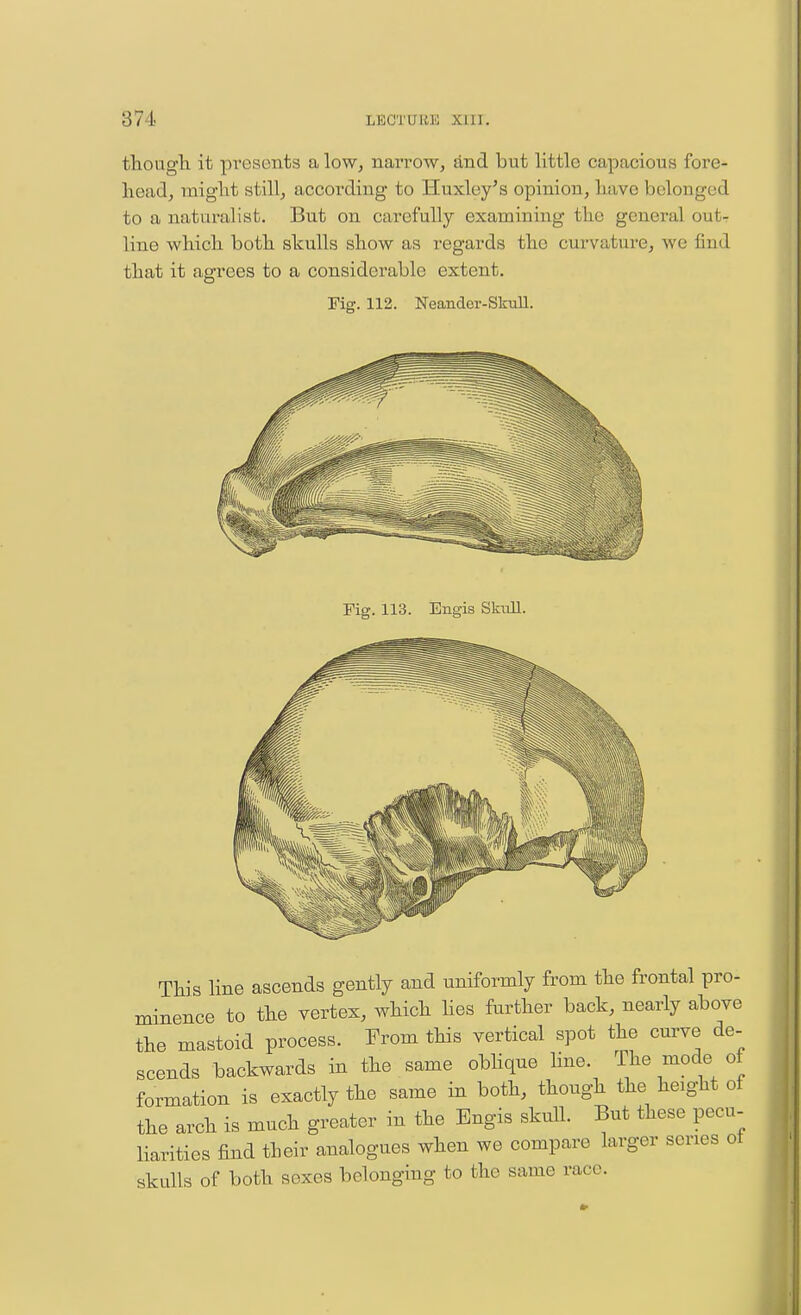 thougli it presents a low, narrow, and but little capacious fore- head, might still, according to Huxley's opinion, have belonged to a naturalist. But on carefully examining the general out- line which both skulls show as regards the curvature, we find that it agrees to a considerable extent. Fig. 112. Neander-SkuU. Fig. 113. Engis SkuU. This line ascends gently and uniformly from the frontal pro- minence to the vertex, which hes further back, nearly above the mastoid process. From this vertical spot the curve de- scends backwards in the same obhque line. The mode of formation is exactly the same in both, though the height of the arch is much greater in the Engis skull. But these pecu- liarities find their analogues when we compare larger series ot skulls of both sexes belonging to the same race.