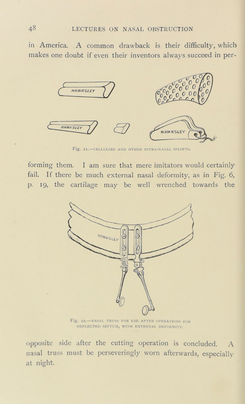 in America. A common drawback is their difficulty, which makes one doubt if even their inventors alwavs succeed in per- Fig. II.—CELLULOID AND OT lorming them. I am sure that fail. If there be much external p. 19, the cartilage may be mere imitators would certainly nasal deformity, as in Fig. 6, well wrenched towards the DEFLECTED SEPTUM, WITH EXTEKNAI. DEFOKMIT^'. opposite side after the cutting operation is concluded. A nasal truss must be perseveringly worn afterwards, especially at night.