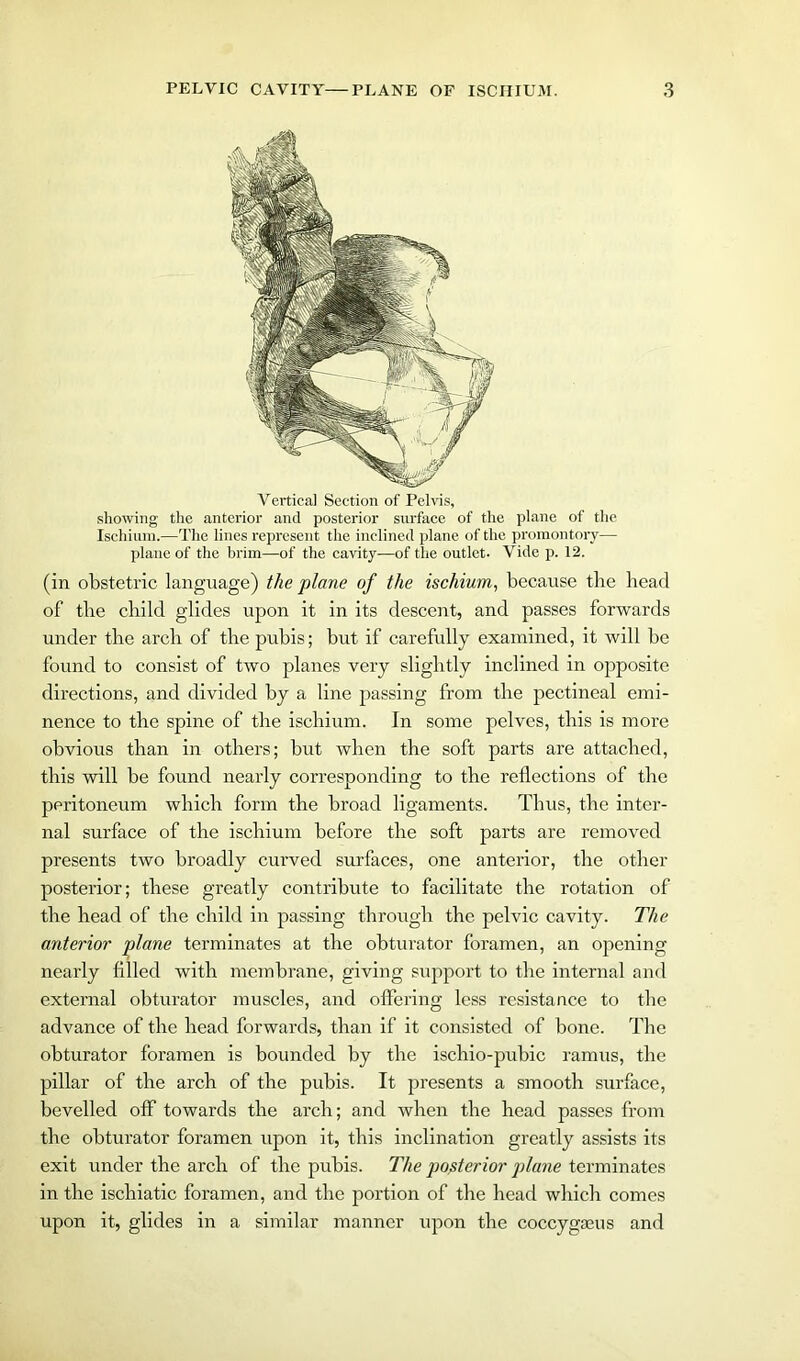 Vertica] Section of Pelvis, showing the anterior and posterior surface of the plane of the Ischium.—The lines represent the inclined plane of the promontory— plane of the brim—of the cavity—of the outlet. Vide p. 12. (in obstetric language) the plane of the ischium, because the bead of the child glides upon it in its descent, and passes forwards under the arch of the pubis; but if carefully examined, it will be found to consist of two planes very slightly inclined in opposite directions, and divided by a line passing from the pectineal emi- nence to the spine of the ischium. In some pelves, this is more obvious than in others; but when the soft parts are attached, this will be found nearly corresponding to the reflections of the peritoneum which form the broad ligaments. Thus, the inter- nal surface of the ischium before the soft parts are removed presents two broadly curved surfaces, one anterior, the other posterior; these greatly contribute to facilitate the rotation of the head of the child in passing through the pelvic cavity. The anterior plane terminates at the obturator foramen, an opening nearly filled with membrane, giving support to the internal and external obturator muscles, and offering less resistance to the advance of the head forwards, than if it consisted of bone. The obturator foramen is bounded by the ischio-pubic ramus, the pillar of the arch of the pubis. It presents a smooth surface, bevelled off towards the arch; and when the head passes from the obturator foramen upon it, this inclination greatly assists its exit under the arch of the pubis. The posterior plane terminates in the iscliiatic foramen, and the portion of the head which comes upon it, glides in a similar manner upon the coccygasus and
