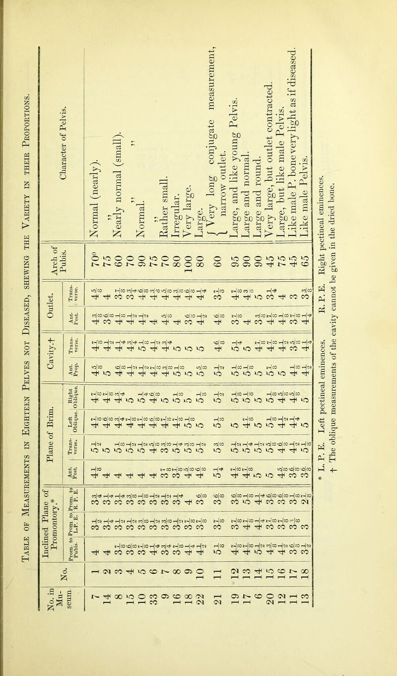 Table of Measurements in Eighteen Pelves not Diseased, shewing the Variety in their Proportions. bX) J> '5 Oh <D> ^P <D dp CO +3 -+—> • f—t P > r5 rP g SZJ g bD PI o o a> h M p t> 02 s bD p pi O ;op S3 i> o> p . o ,.PrH • h ^ m P m rH rj ^ 5P b ^ !> _! — ; dP P P P +P 0) w 1 § £ fH ^ Q_. O) bp £ . dp dp P P c3 c3 d <D CD <D .0) -1 M bo bo bo cO <d v Arch of Pubis. 0*0000100000 O *000*0*0*0*0 NNtONfflNNOOOOO CO Cl C5 05 rf N ^ (C i-H Outlet. Trans- verse. lojco p-jco Co|rf< tofco cq'oo lr^CO CO|COO(CO r-ljrft b-|cO fc-[c0C0X> r-^ Co]C0 ^TfCOCO^Tf^T^i^Tti co ^ d »0 CO d co CO a s C^)C0«o[C0 d°° lo'co to'CO <-|o) <OC0 b-jco ec|OOk-|cOiH[OOfc-[cO dFcO^^TF^dF^COTf* rfr< CO rt* CO ^ CO rt1 Cavity.f I Trans- verse. b-[CO '^1-^ d03 <O|C0 th|t* t-jCOb-IOOr-f^^COH^ ^ »0 ‘O d ^ d CO d *s a o S ^Ph »O|c0 <©[cO r-^O* r-(oi t-[C0 eo)CO r-)|C0 »ojC0 r-(o4 r^COr^C© t-[cO i-njcO r-jo> VO VO VO vo VO VO -rf Plane of Brim. 22 o b-fcot-jcoeo^ i-h't* <o'C0 T-l|CO r-^CO r-|oi r-^CO r-<jCO r-{CO »Of00 »o[CO ^^^‘0‘6^iO»OOVO VO vo vo vo vo ^ vo « % o t-|co<o|co cof-tf b-|cot-|cO'.o[cob-[cot'-|co d00 h[co b-|co th(co *-<1^ ^^^^T^'^’^TiiiO‘0 vo vo d1 *o vo d d vo Trans- verse. t-/CO r-^o» 04 »o[CO so1 CO-h|^ c^|COCO,'00 r-{c4 r-ljr# i-(o4 >o(cO<o|C0 r^CO vOvovovovo^iCOvovovo vo vo ‘O »0 iO ^ d vo *S *5 a £ ih|0O t- CO t-[C0 *o|cO «O[c0 t-|cot-|co *o|co'cjco'cjco ^^^^^^COCO’xh^ vo d ^ *o >o d CO CO Inclined Plane of Promontory.* Prom, to R. P. E. co|C0 H00 HC) M00 '°{C0 'O|c0w|C0 r-ljrjf o[cO to[C0 t—<|C0 t^JcO cocococococococodco CO co vo CO CO CO (M o . g#; <£J *-{04 rH|r}< r—jO) *-jo) Co[cO t-^O) Ca|cO t—t-{c0t-[C0 t-[cO t-|cO t-)CO t-[cO t-|C0 ^[CO COCOCOCOCOCOCOCOCOCO CO CO d d CO CO CO CO Prom, to Pubis, j t^co<©lcot'-|coi-^ coj^ e-jco rH|rf- r-joi rn|co t-{cot-|co T-<fo) co|cot-^o) ojco r-jo> rtfd|COCOCOdCOCOd'^ vo T^^voTf^COCO No. H«cc^*ocoNoooio i—i (N n ^ *o io t- oo i—H i-H j—1 r—i i-H i—( r—( i—( i-H No. in Mu- seum N^QOUOOCOCJCDOOCq I-H aNCOO(NHCOi i-H r—H i-H CO rH rH 0!| d i-H r-H C] i-H i—i —( '■ * L. P. E. Left pectineal eminences. E. P. E. Eight pectineal eminences, f The oblique measurements of the cavity cannot be given in the dried hone.