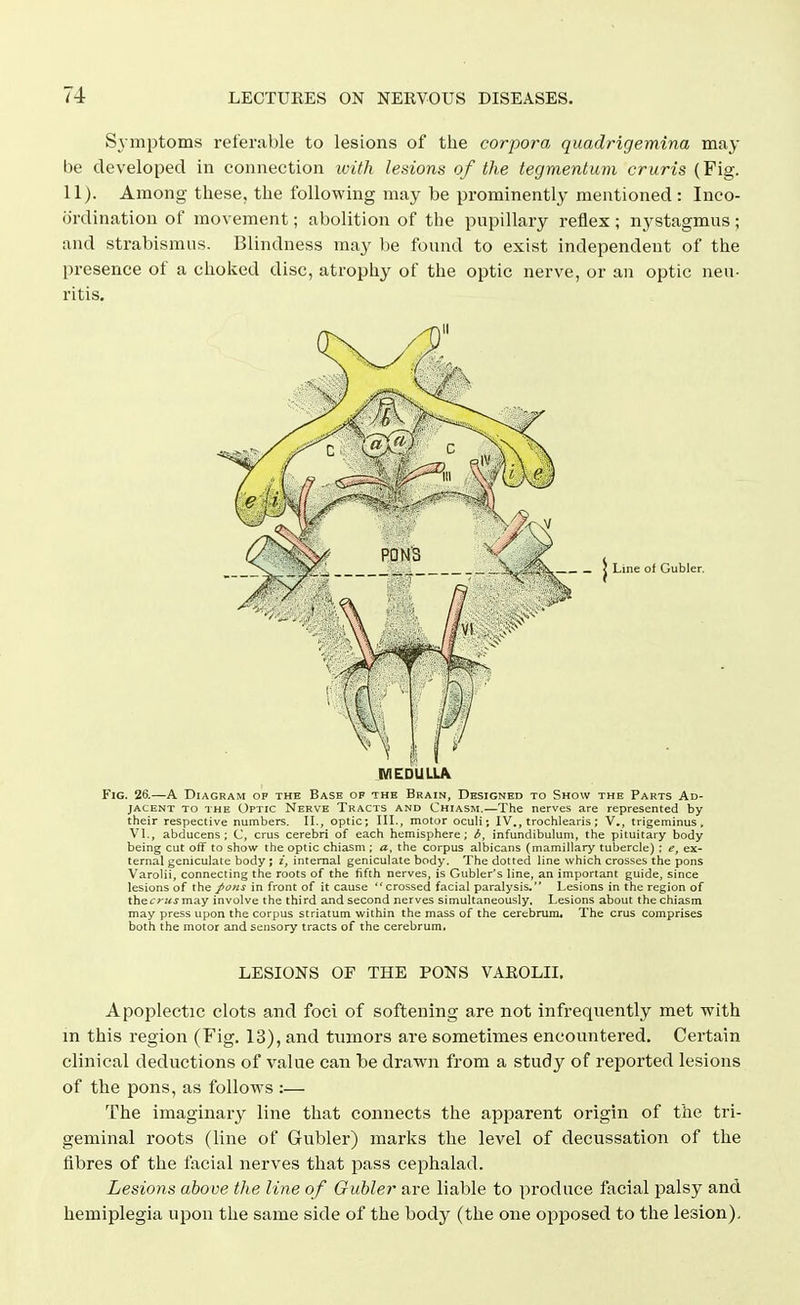 S3-mptoms referable to lesions of the corpora quadrigemina may be developed in connection with lesions of the tegmentum cruris (Fig. 11). Among these, the following may be prominently mentioned : Inco- ordination of movement; abolition of the pupillary reflex ; nystagmus ; and strabismus. Blindness may l)e found to exist independent of the presence of a choked disc, atrophy of the optic nerve, or an optic neu- ritis. Line of Gubler, MEDUUA Fig. 26.—A Diagram op the Base of the Brain, Designed to Show the Parts Ad- jacent TO THE Optic Nerve Tracts and Chiasm.—The nerves are represented by their respective numbers. 11., optic; III., motor ocuh; IV., trochlearis; V,, trigeminus» VI., abducens ; C, crus cerebri of each hemisphere; i, infundibulum, the pituitary body being cut off to show the optic chiasm ; a, the corpus albicans (mamillary tubercle) ; e, ex- ternal geniculate body ; i, internal geniculate body. The dotted line which crosses the pons Varolii, connecting the roots of the fifth nerves, is Gubler's line, an important guide, since lesions of the pons in front of it cause crossed facial paralysis. Lesions in the region of thecrus may involve the third and second nerves simultaneously. Lesions about the chiasm may press upon the corpus striatum within the mass of the cerebrum. The crus comprises both the motor and sensory tracts of the cerebrum, LESIONS OF THE PONS VAROLII. Apoplectic clots and foci of softening are not infrequently met with m this region (Fig. 13), and tumors ai'e sometimes encountered. Certain clinical deductions of value can be drawn from a study of reported lesions of the pons, as follows :— The imaginary line that connects the apparent origin of the tri- geminal roots (line of Gubler) marks the level of decussation of the fibres of the facial nerves that pass cephalad. Lesions above the line of Gubler are liable to produce facial palsy and hemiplegia upon the same side of the body (the one opposed to the lesion).