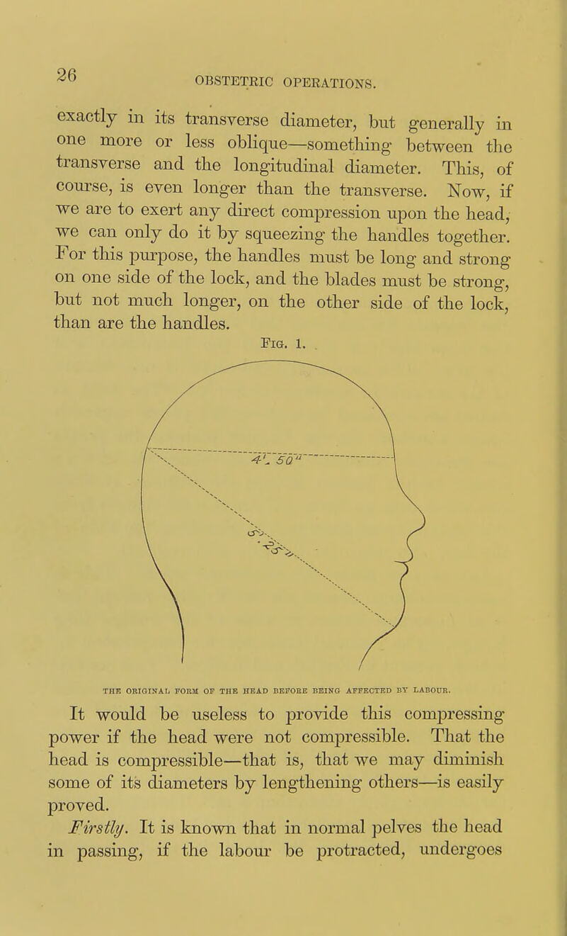OBSTETRIC OPERATIONS. exactly in its transverse diameter, but generally in one more or less oblique—something between the transverse and the longitudinal diameter. This, of course, is even longer than the transverse. Now, if we are to exert any direct comiDression upon the head, we can only do it by squeezing the handles together. For this purpose, the handles must be long and strong on one side of the lock, and the blades must be strong, but not much longer, on the other side of the lock, than are the handles. Pig. 1. THE ORIGINAL FOKM OF THE HEAD BEFOHE BEING AFFECTED BY LABOUR. It would be useless to provide this compressing power if the head were not compressible. That the head is compressible—that is, that we may diminish some of its diameters by lengthening others—^is easily proved. Firstly. It is known that in normal pelves the head in passing, if the labour be protracted, undergoes