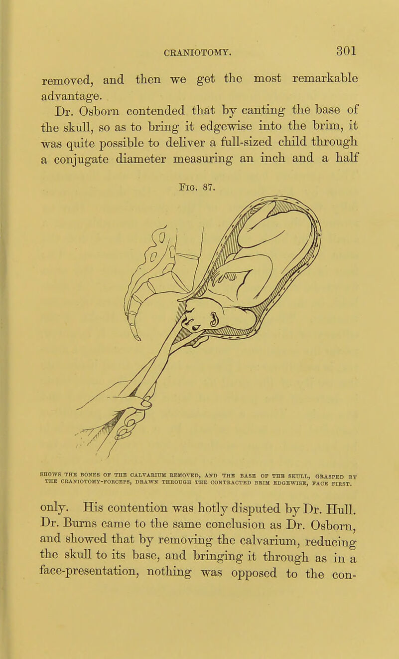 removed, and then we get the most remarkable advantage. Dr. Osborn contended that by canting the base of the skull, so as to bring it edgewise into the brim, it was quite possible to deliver a full-sized child through a conjugate diameter measuring an inch and a half Fig. 87. SHOWS THE BONES OF THE OALTARIUM REMOVED, AND THE BASE OF THE SKULL, GEASPED BY THE CRANIOTOMY-FORCEPS, DRAWN THHODGH THE CONTRACTED BRIM EDGEWISE, FACE FIRST. only. His contention was hotly disputed by Dr. Hull. Dr. Bums came to the same conclusion as Dr. Osborn, and showed that by removing the calvarium, reducing the skull to its base, and bringing it through as in a face-presentation, nothing was opposed to the con-