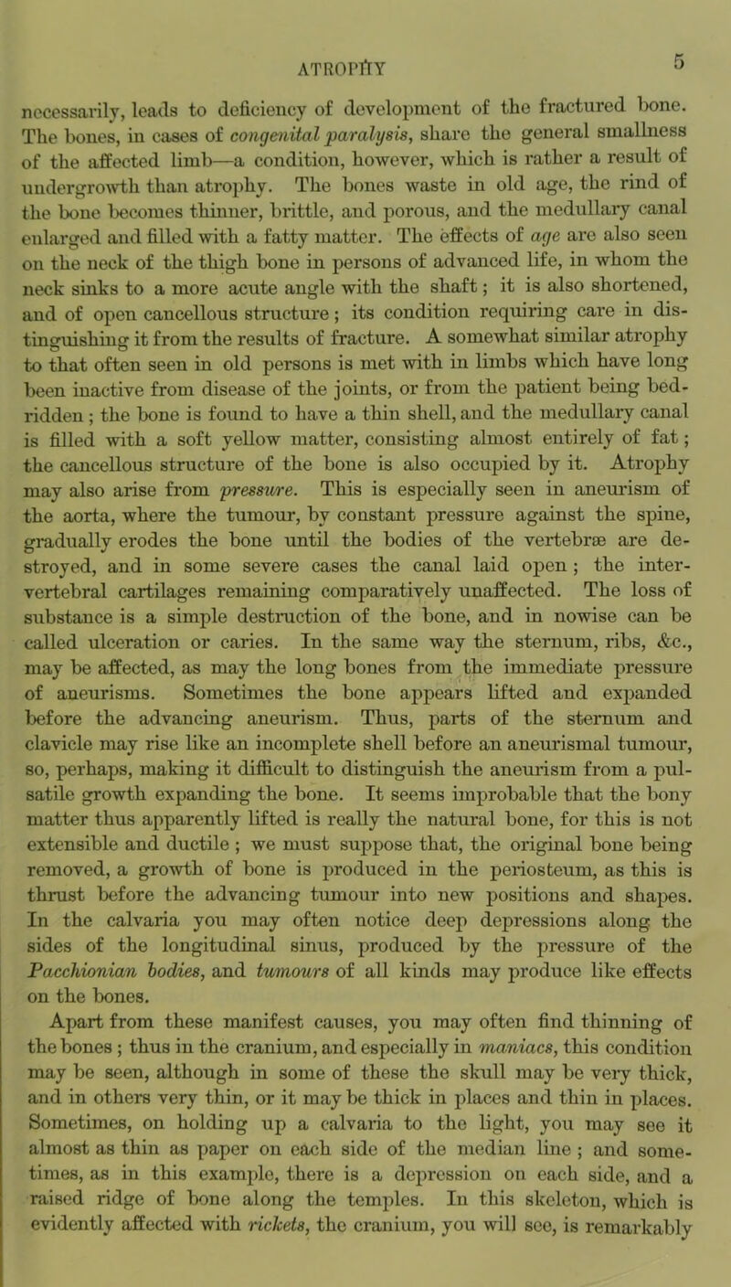 ATROPrtY necessarily, leads to deficiency of development of the fractured bone. The bones, in cases of congenital paralysis, share the general smallness of the affected limb—a condition, however, which is rather a result of undergro^vth than atrophy. The bones waste in old age, the rind of the bone becomes thinner, brittle, and porous, and the medullary canal enlarged and filled with a fatty matter. The effects of age are also seen on the neck of the thigh bone in persons of advanced life, in whom the neck sinks to a more acute angle with the shaft; it is also shortened, and of open cancellous structure; its condition requiring care in dis- tinguishing it from the results of fracture. A somewhat similar atrophy to that often seen in old persons is met with in limbs which have long been inactive from disease of the joints, or from the patient being bed- ridden ; the bone is found to have a thin shell, and the medullary canal is filled with a soft yellow matter, consisting almost entirely of fat; the cancellous structure of the bone is also occupied by it. Atrophy may also arise from presstire. This is especially seen in aneui'ism of the aorta, where the tumour, by constant pressure against the spine, gradually erodes the bone until the bodies of the vertebrae are de- stroyed, and in some severe cases the canal laid open; the inter- vertebral cartilages remaining comparatively unaffected. The loss of substance is a simple destruction of the bone, and in nowise can be called ulceration or caries. In the same way the sternum, ribs, &c., may be affected, as may the long bones from ^the immediate pressure of aneurisms. Sometimes the bone appears lifted and expanded before the advancing aneurism. Thus, parts of the sternum and clavicle may rise like an incomplete shell before an aneurismal tumour, so, perhaps, making it difficult to distinguish the aneurism from a pul- satile growth expanding the bone. It seems improbable that the bony matter thus apparently lifted is really the natural bone, for this is not extensible and ductile ; we must suppose that, the original bone being removed, a growth of bone is produced in the periosteum, as this is thrust before the advancing tumour into new positions and shapes. In the calvaria you may often notice deep dej^ressions along the sides of the longitudinal sinus, produced by the i)ressure of the Pacchionian bodies, and tumours of all kinds may j>roduce like effects on the bones. Apart from these manifest causes, you may often find thinning of the bones ; thus in the cranium, and especially in maniacs, this condition may be seen, although in some of these the skull may be very thick, and in others very thin, or it may be thick in places and thin in places. Sometimes, on holding up a calvaria to the light, you may see it almost as thin as paper on each side of the median line ; and some- times, as in this example, there is a depression on each side, and a raised ridge of bone along the temples. In this skeleton, which is evidently affected with rickets, the cranium, you will see, is remarkably