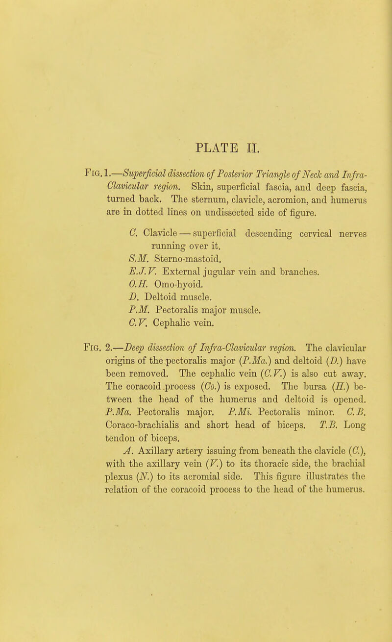 F[G. 1,—Superficial dissection of Posterior Triangle of Ned and Infra- Clavicular region. Skin, superficial fascia, and deep fascia, turned back. The sternum, clavicle, acromion, and humerus are in dotted lines on undissected side of figure. C. Clavicle — superficial descending cervical nerves running over it. S.M. Sterno-mastoid. E.J. V. External jugular vein and branches. O.H. Omo-hyoid. D. Deltoid muscle. P.M. Pectoralis major muscle. C. V. Cephalic vein. Fig. 2.—Deep dissection of Infra-Clavicidar region. The clavicular origins of the pectoralis major (P.Ma.) and deltoid (D.) have been removed. The cephalic vein (C. V.) is also cut away. The coracoid .process (Co.) is exposed. The bursa (R.) be- tween the head of the humerus and deltoid is opened. P.Ma. Pectoralis major. P.Mi. Pectoralis minor. G.B. Coraco-brachialis and short head of biceps. T.B. Long tendon of biceps. A. Axillary artery issuing from beneath the clavicle (C), with the axillary vein (F.) to its thoracic side, the brachial plexus (N.) to its acromial side. This figure illustrates the relation of the coracoid process to the head of the humerus.