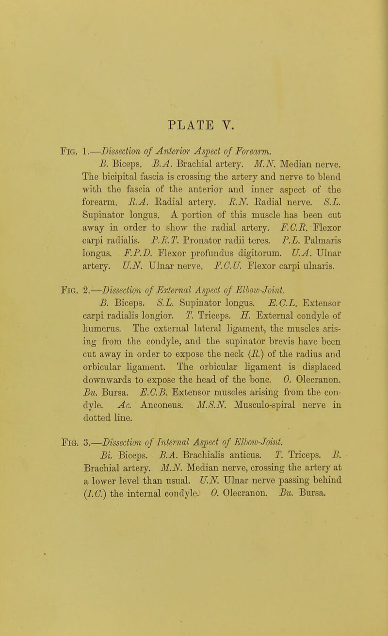 Fig. 1.—Dissection of Anterior Aspect of Forearm. B. Biceps. B.A. Brachial artery. M.N. Median nerve. The bicipital fascia is crossing the artery and nerve to blend with the fascia of the anterior and inner aspect of the forearm. B.A. Radial artery. B.N. Eadial nerve. S.L. Supinator longus. A portion of this muscle has been cut away in order to show the radial artery. F.G.B. Flexor carpi radialis. F.B.T. Pronator radii teres. P.L. Palmaris longus. F.P.D. Flexor profundus digitorum. U.A. Ulnar artery. U.N. Ulnar nerve. F.C.U. Flexor carpi ulnaris. Fig. 2.—Dissection of External Aspect of Elboiv-Joint. B. Biceps. S.L. Supinator longus. E.C.L. Extensor carpi radialis longior. T. Triceps. H. External condyle of humerus. The external lateral ligament, the muscles aris- ing from the condyle, and the supinator brevis have been cut away in order to expose the neck (B.) of the radius and orbicular ligament. The orbicular ligament is displaced downwards to expose the head of the bone. 0. Olecranon. Bii. Bursa. F.G.B. Extensor muscles arising from the con- dyle. Ac. Anconeus. M.S.N. Musculo-spiral nerve in dotted line. Fig. 3.—Dissection of Internal Aspect of Flboiv-Joint. Bi. Biceps. B.A. Brachialis anticus. 2\ Triceps. B. Brachial artery. M.N. Median nerve, crossing the artery at a lower level than usual. U.N. Ulnar nerve passing behind (I.e.) the internal condyle. 0. Olecranon. Bii. Bursa.