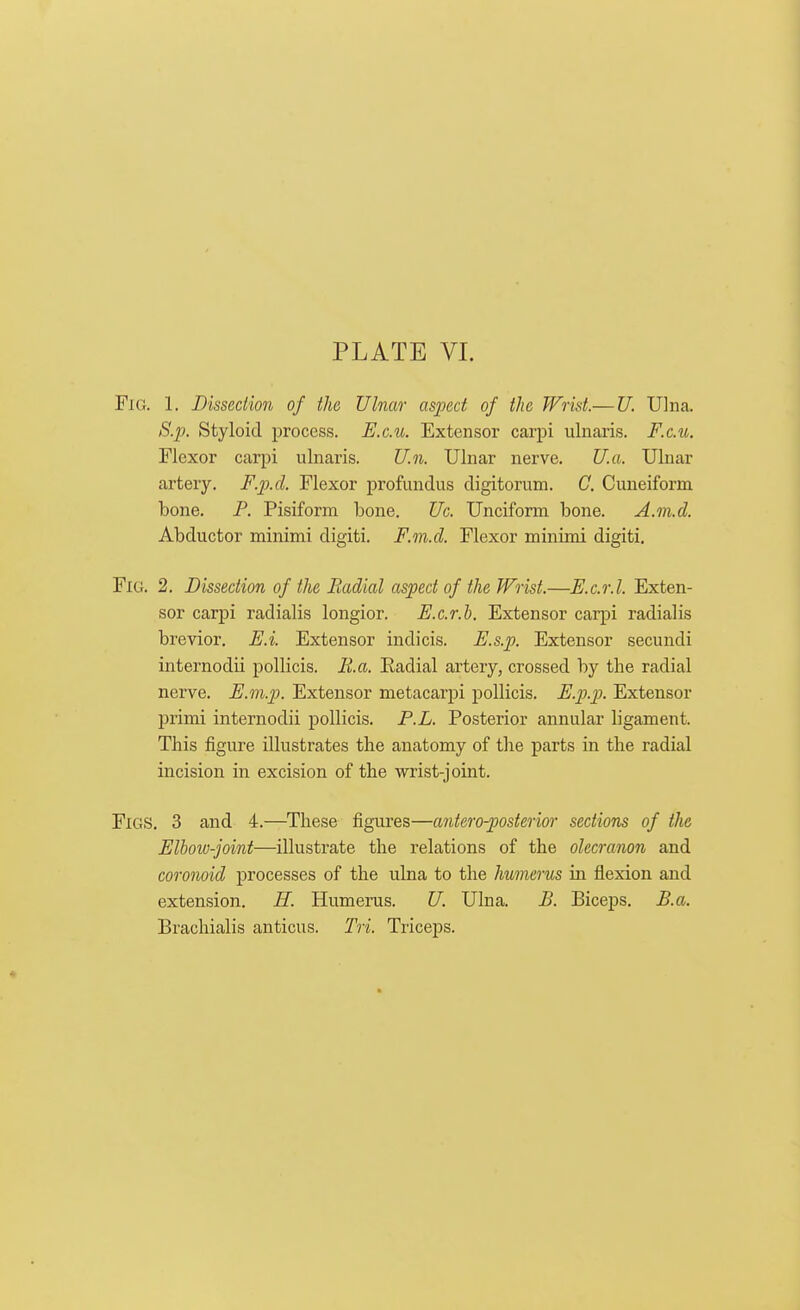 Fig. 1. Dissection of the Ulnar aspect of the Wrist.— U. Ulna. S.p. Styloid process. E.cal Extensor carpi ulnaris. F.c.u. Flexor carpi ulnaris. U.n. Ulnar nerve. U.a. Ulnar artery. F.p.d. Flexor profundus digitorum. C. Cuneiform bone. P. Pisiform bone. Uc. Unciform bone. A.m.d. Abductor minimi digiti. F.m.d. Flexor minimi digiti. Fig. 2. Dissection of the Radial aspect of the Wrist.—E.c.r.l. Exten- sor carpi radialis longior. E.c.r.h. Extensor carpi radialis brevior. E.i. Extensor indicis. E.s.p. Extensor secundi internodii pollicis. B.a. Eadial artery, crossed by the radial nerve. E.m.p. Extensor metacarpi pollicis. E.p.p. Extensor primi internodii pollicis. P.L. Posterior annular ligament. This figure illustrates the anatomy of the parts in the radial incision in excision of the wrist-joint. Figs. 3 and 4.—These figures—anteroposterior sections of the Elbow-joint—illustrate the relations of the olecranon and coronoid processes of the ulna to the humerus in flexion and extension. H. Humerus. U. Ulna. B. Biceps. B.a. Bracliialis anticus. Tri. Triceps.