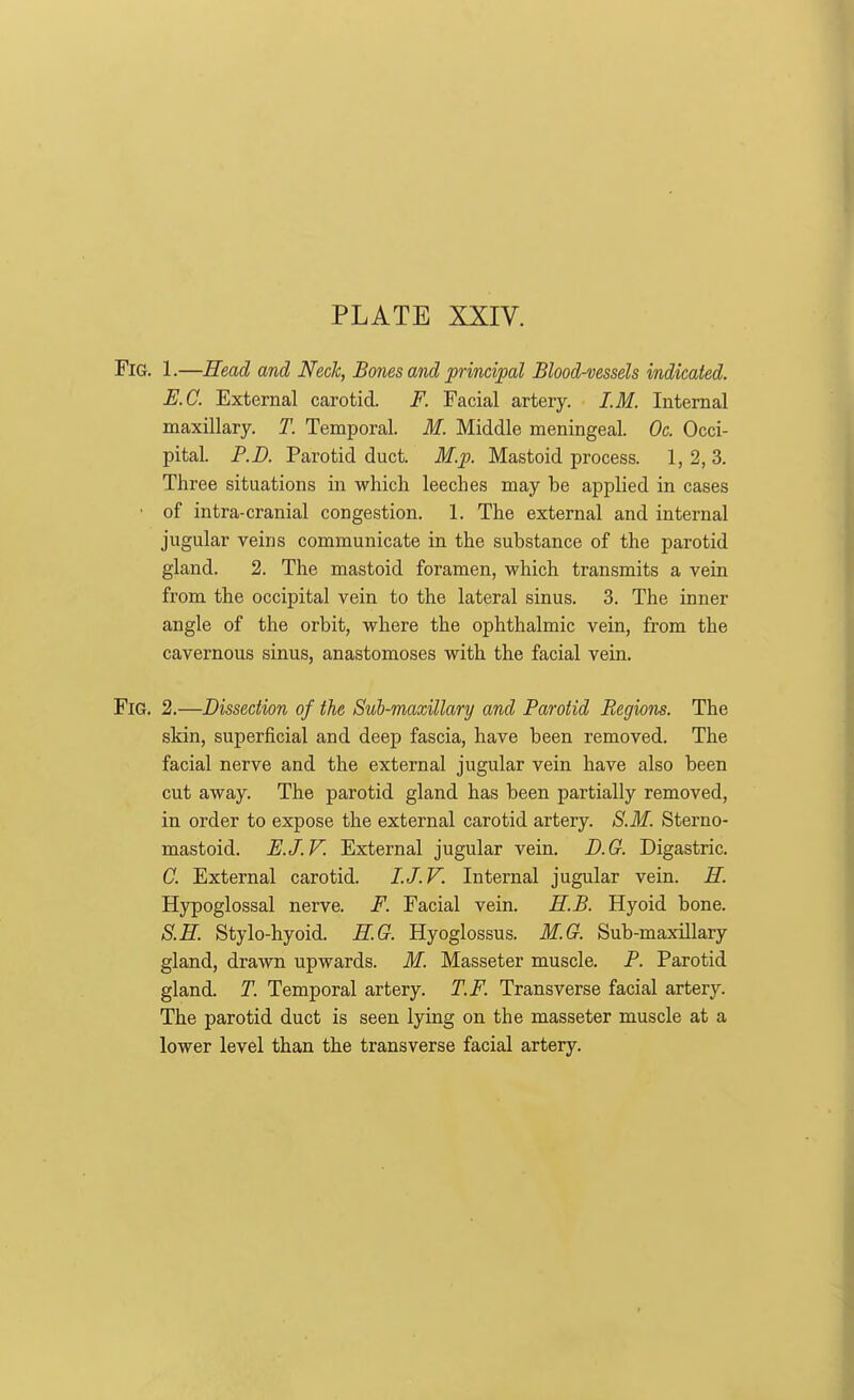 Fig. 1.—Head and Neck, Bones and principal Blood-vessels indicated. E.C. External carotid. F. Facial artery. I.M. Internal maxillary. T. Temporal. M. Middle meningeal. Oc. Occi- pital. P.D. Parotid duct. M.p. Mastoid process. 1, 2, 3. Three situations in which leeches may be applied in cases • of intra-cranial congestion. 1. The external and internal jugular veins communicate in the substance of the parotid gland. 2. The mastoid foramen, which transmits a vein from the occipital vein to the lateral sinus. 3. The inner angle of the orbit, where the ophthalmic vein, from the cavernous sinus, anastomoses with the facial vein. Fig. 2.—Dissection of the Sub-maxillary and Parotid Regionis. The skin, superficial and deep fascia, have been removed. The facial nerve and the external jugular vein have also been cut away. The parotid gland has been partially removed, in order to expose the external carotid artery. S.M. Sterno- mastoid. E.J.V. External jugular vein. D.G. Digastric. C. External carotid. I.J.V. Internal jugular vein. H. Hjrpoglossal nerve. F. Facial vein. H.B. Hyoid bone. S.E. Stylo-hyoid. E.G. Hyoglossus. M.G. Sub-maxillary gland, drawn upwards. M. Masseter muscle. P. Parotid gland. T. Temporal artery. T.F. Transverse facial artery. The parotid duct is seen lying on the masseter muscle at a lower level than the transverse facial artery.