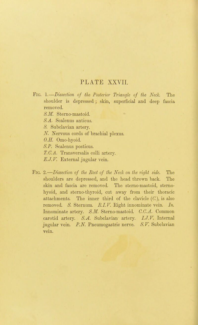 Fig. 1.—Dissection of the Posterior Triangle of the Neck. The shoulder is depressed; skin, superficial and deep fascia removed. S.M. Sterno-mastoid. S.A. Scalenus anticus. *S^. Subclavian artery. N. Nervous cords of brachial plexus. O.H. Omo-hyoid. S.P. Scalenus posticus. T.C.A. Transversalis colli artery. E.J. V. External jugular vein. Fig. 2.—Dissection of the Boot of the Neck on the right side. The shoulders are depressed, and the head thrown back. The skin and fascia are removed. The sterno-mastoid, sterno- hyoid, and sterno-thyroid, cut away from their thoracic attachments. The inner third of the clavicle (C), is also removed. S. Sternum. RI. V. Right innominate vein. In. Innominate artery. S.M. Sterno-mastoid. CCA. Common carotid artery. S.A. Subclavian artery. I.J.V. Internal jugular vein. P.N. Pneumogastric nerve. S. V. Subclavian vein.