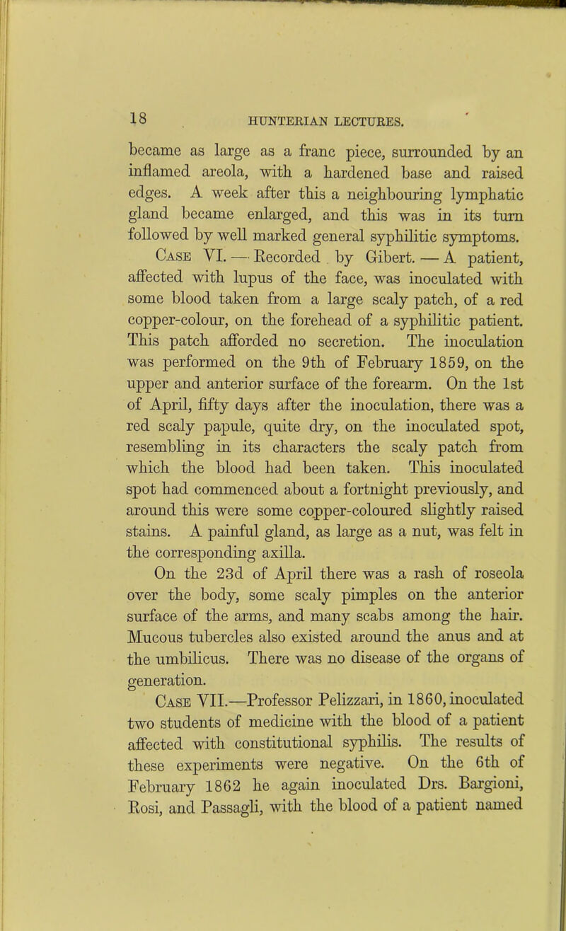 became as large as a franc piece, surrounded by an inflamed areola, with a hardened base and raised edges. A week after this a neighbouring lymphatic gland became enlarged, and this was in its turn followed by well marked general syphilitic symptoms. Case VI. — Recorded by G-ibert. — A patient, affected with lupus of the face, was inoculated with some blood taken from a large scaly patch, of a red copper-colour, on the forehead of a syphilitic patient. This patch afforded no secretion. The inoculation was performed on the 9th of February 1859, on the upper and anterior surface of the forearm. On the 1st of April, fifty days after the inoculation, there was a red scaly papule, quite dry, on the inoculated spot, resembling in its characters the scaly patch from which the blood had been taken. This inoculated spot had commenced about a fortnight previously, and around this were some copper-coloured slightly raised stains. A painful gland, as large as a nut, was felt in the corresponding axilla. On the 23d of April there was a rash of roseola over the body, some scaly pimples on the anterior surface of the arms, and many scabs among the hair. Mucous tubercles also existed around the anus and at the umbilicus. There was no disease of the organs of generation. O Case VII.—Professor Pelizzari, in 1860, inoculated two students of medicine with the blood of a patient affected with constitutional syphilis. The results of these experiments were negative. On the 6th of February 1862 he again inoculated Drs. Bargioni, Rosi, and Passagli, with the blood of a patient named